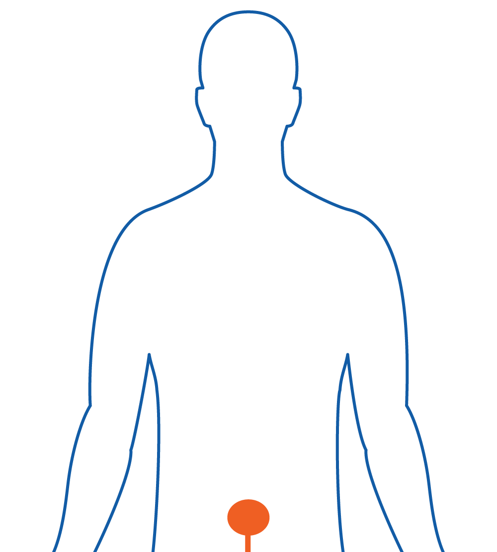 Diagram silhouette of a man and his prostate