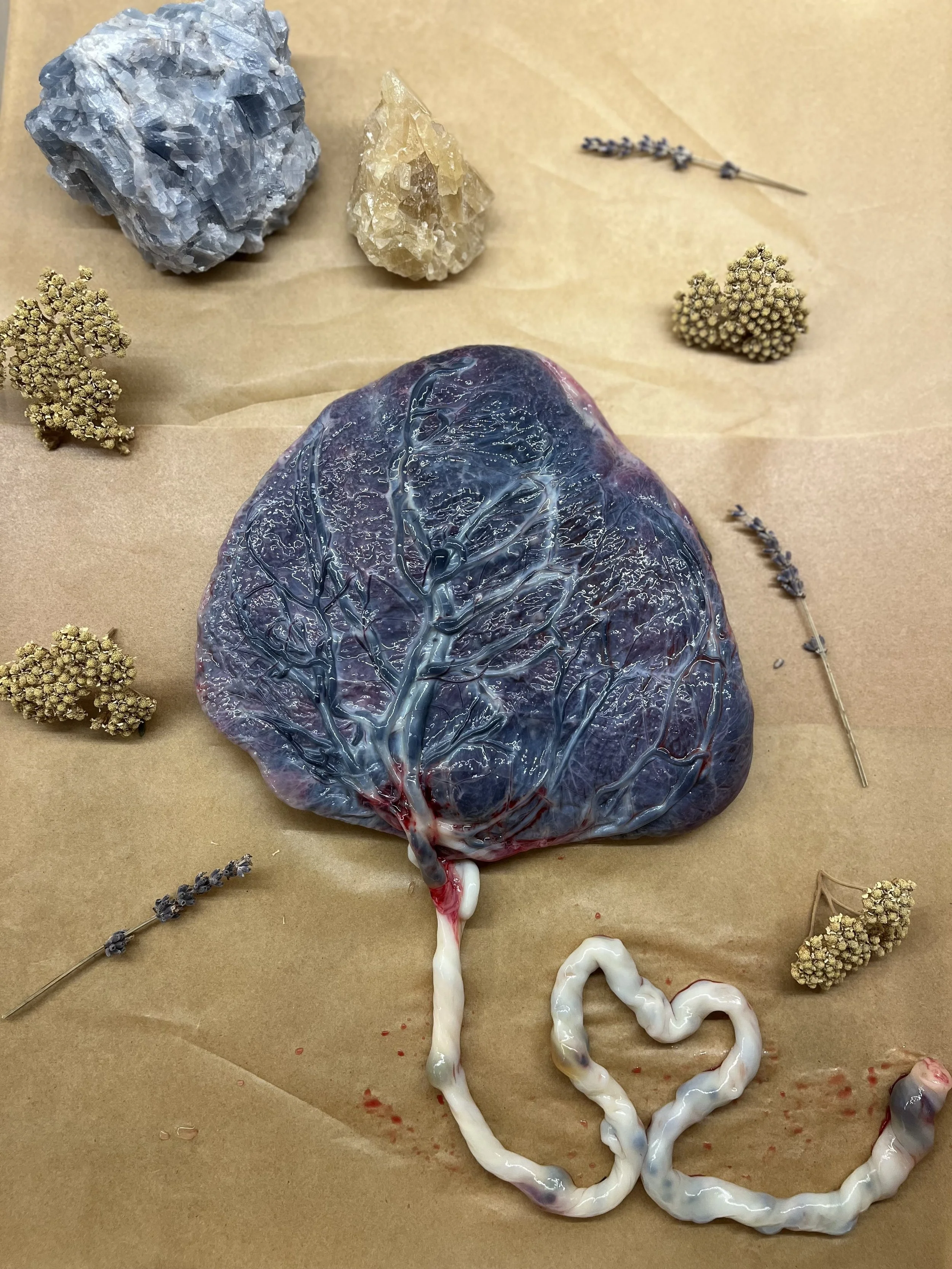 Placenta ready for processing