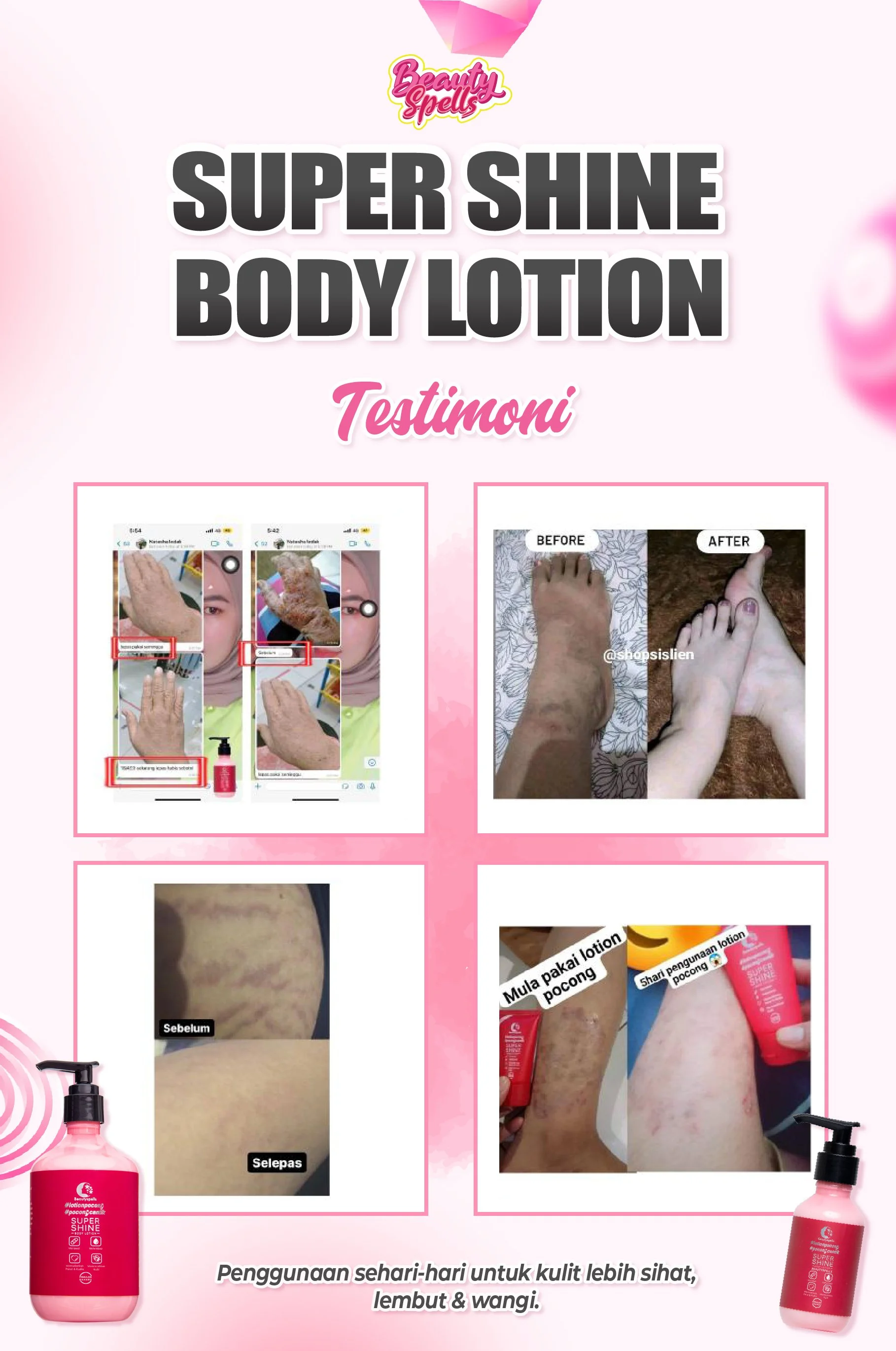 Poster advertising Super Shine Body Lotion with testimonials, before and after photos of skin, and user experiences.