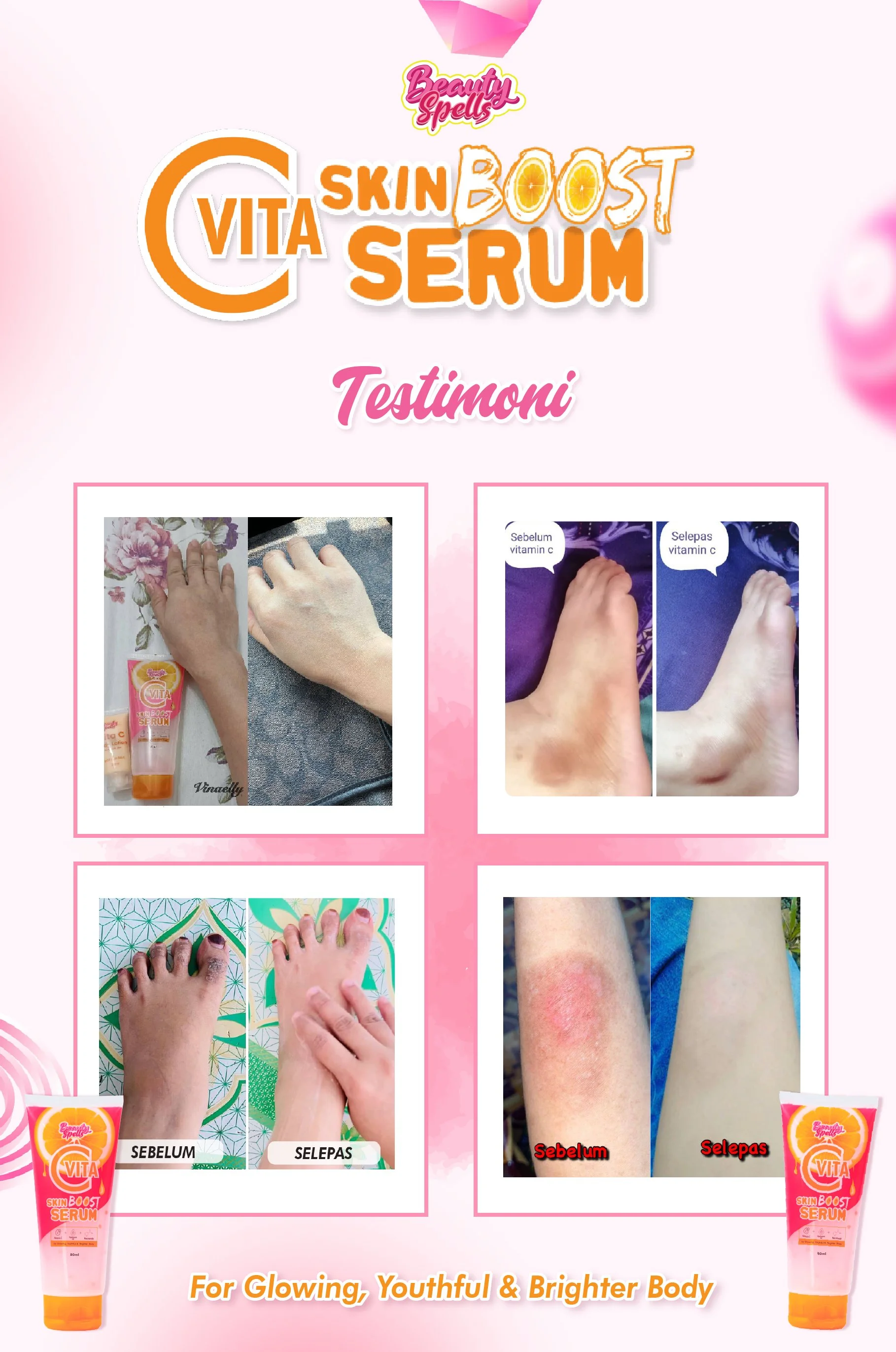 Poster showing before and after photos of skin improvement with Vita Skin Boost Serum, including skin on hand, foot, or leg, with labels in Turkish 'Sebelum' (before) and 'Seppas' (after).