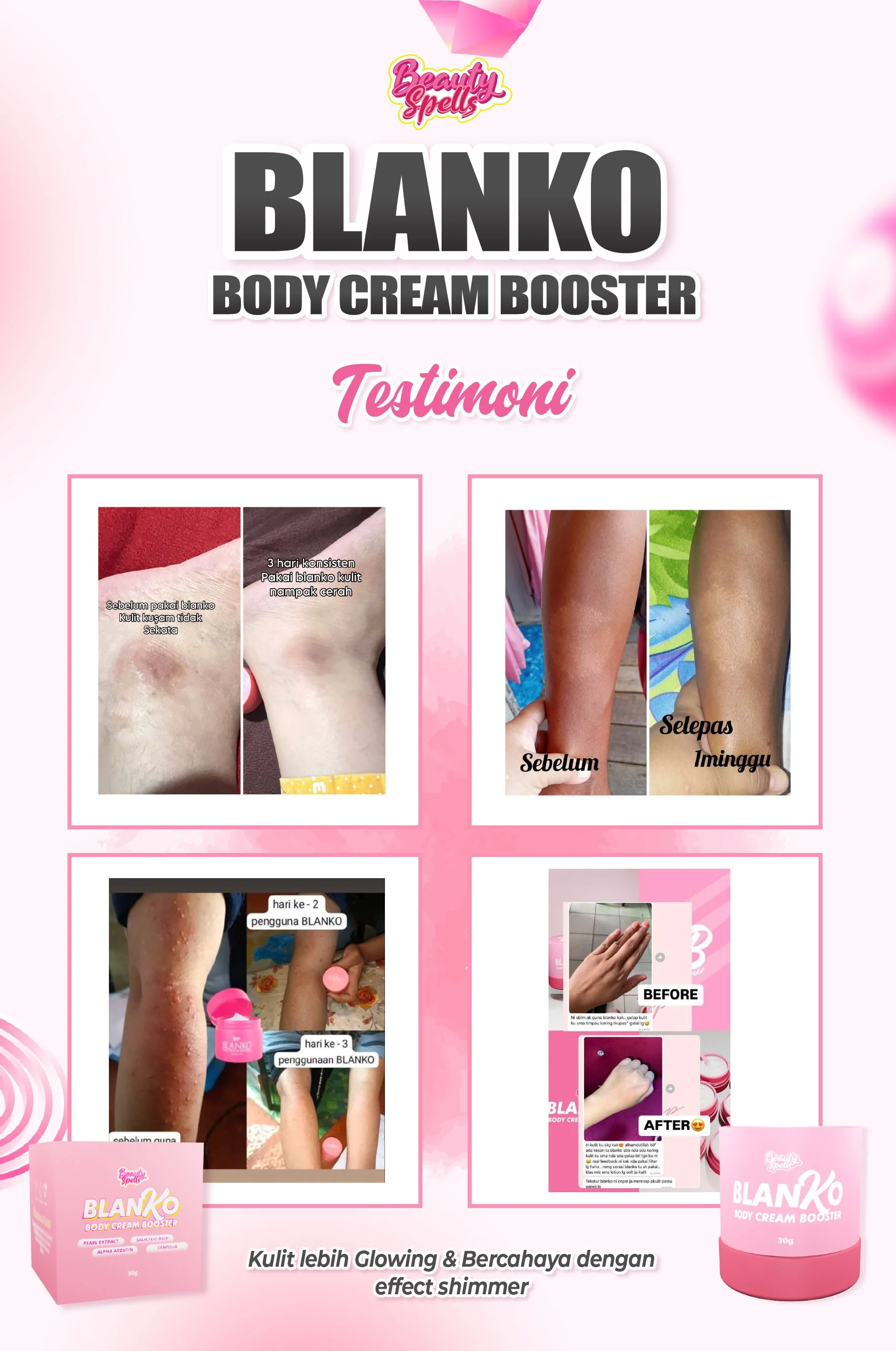 Testimonial poster for BLANKO Body Cream Booster showing before-and-after images of improved skin on legs, with text in Malay indicating skin brightening and glow enhancement, and product images at the bottom.