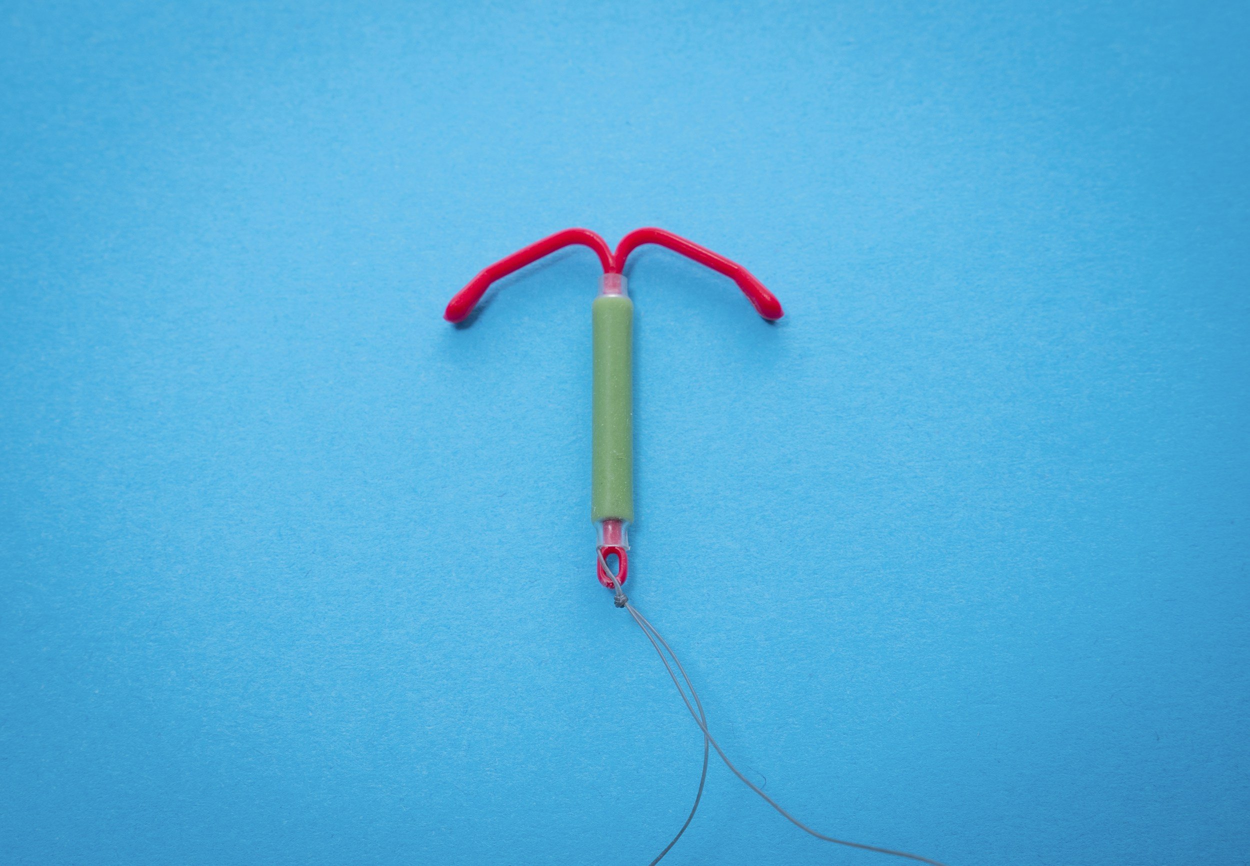 The IUD Experience: What to Expect