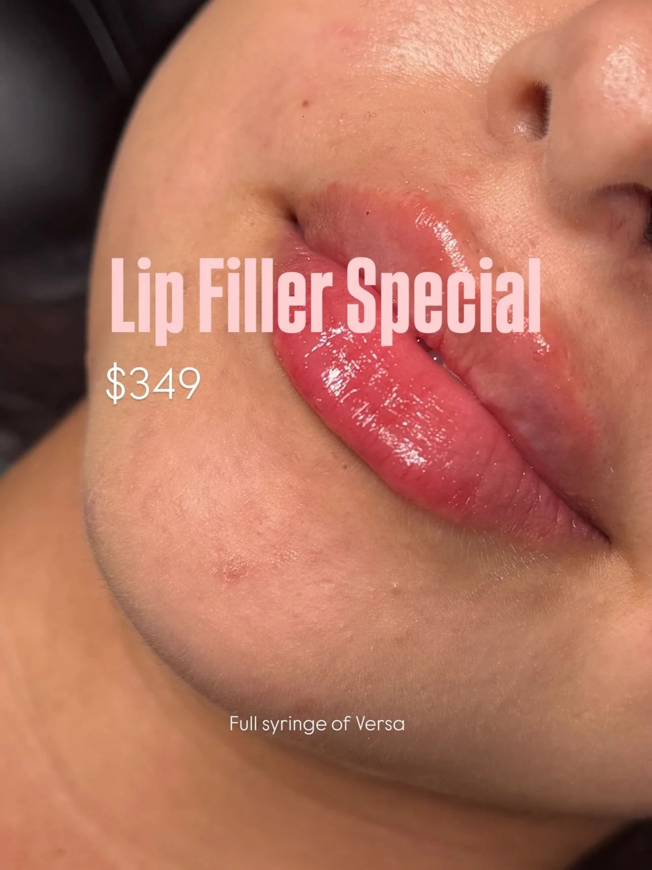 👄Lip Filler Special Extended through October!! 

🔥$349 full syringe 

STAY TUNED FOR OCTOBER SPECIALS DROPPING TODAY 🎃

Book at Spalinatx.com or DM me 🫶