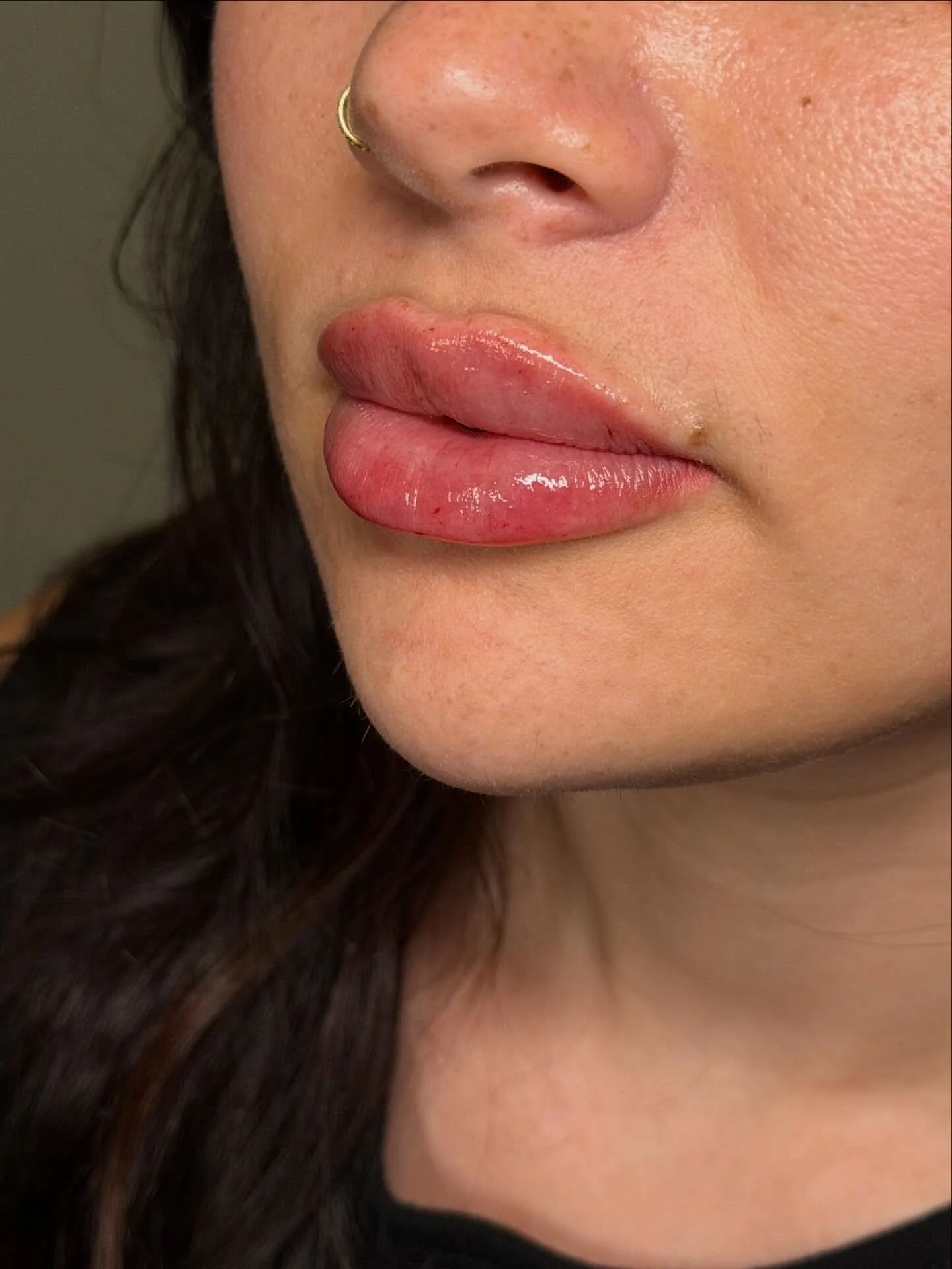 $349 Lip filler ending October 31st 🎃 don&rsquo;t miss out babes !