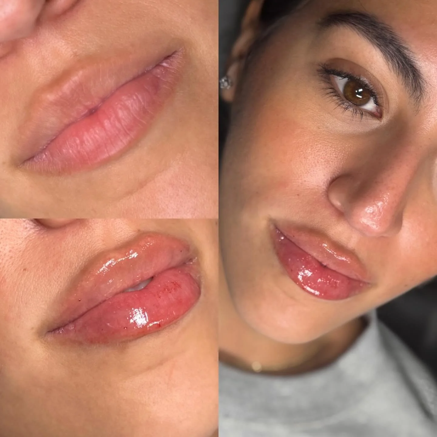These are the Spotlight lips for the month! Absolutely perfect 🥹🥲 $349 Lip Filler