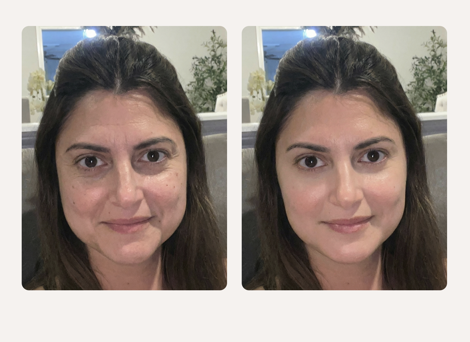 Elite Derma Med Spa
