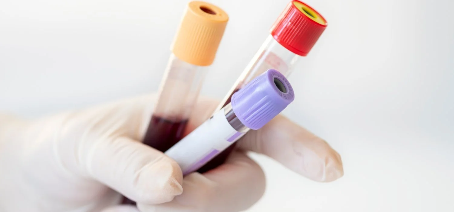 fertility blood testing