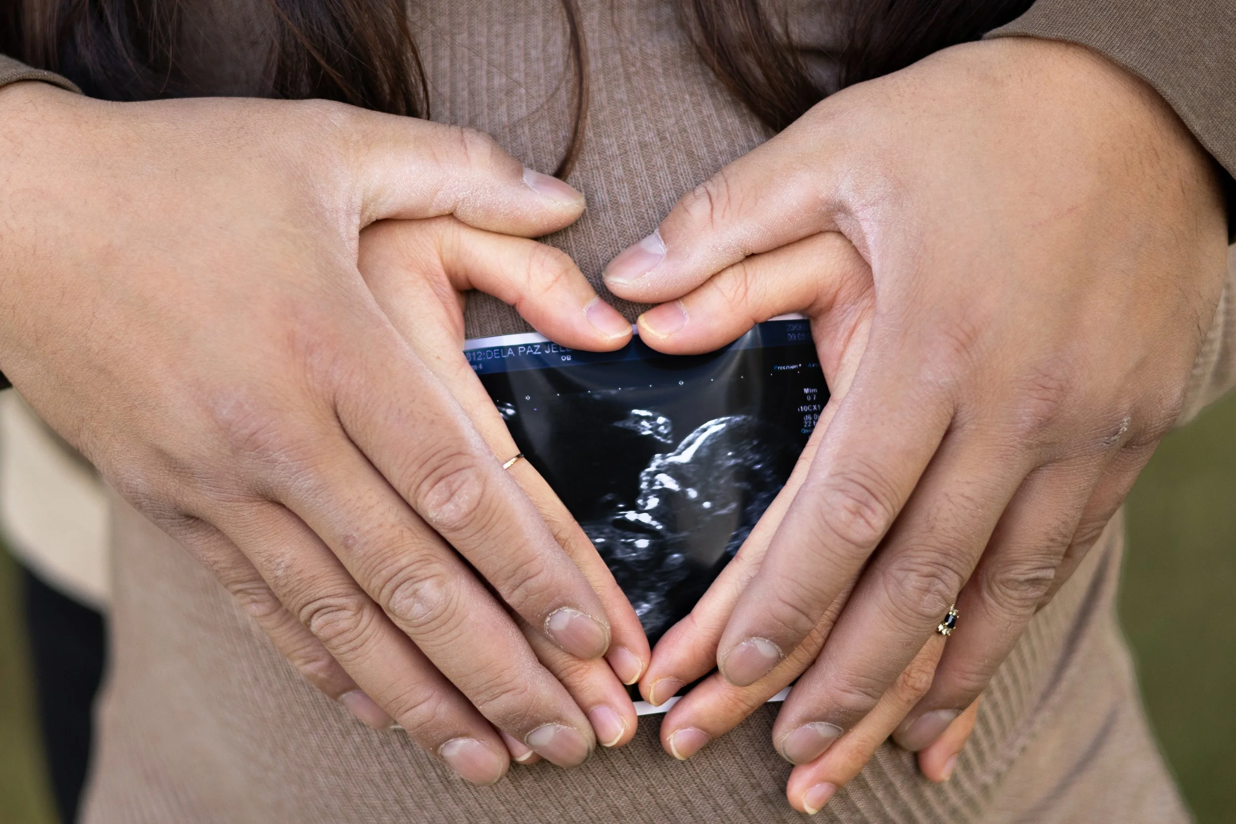 Close-up of hands forming a heart around an ultrasound photo during a maternity session at Nose Creek Park in Airdrie, symbolizing love and anticipation.