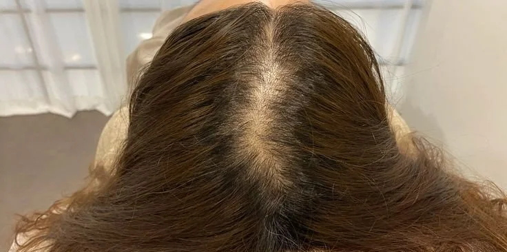 Before hair result