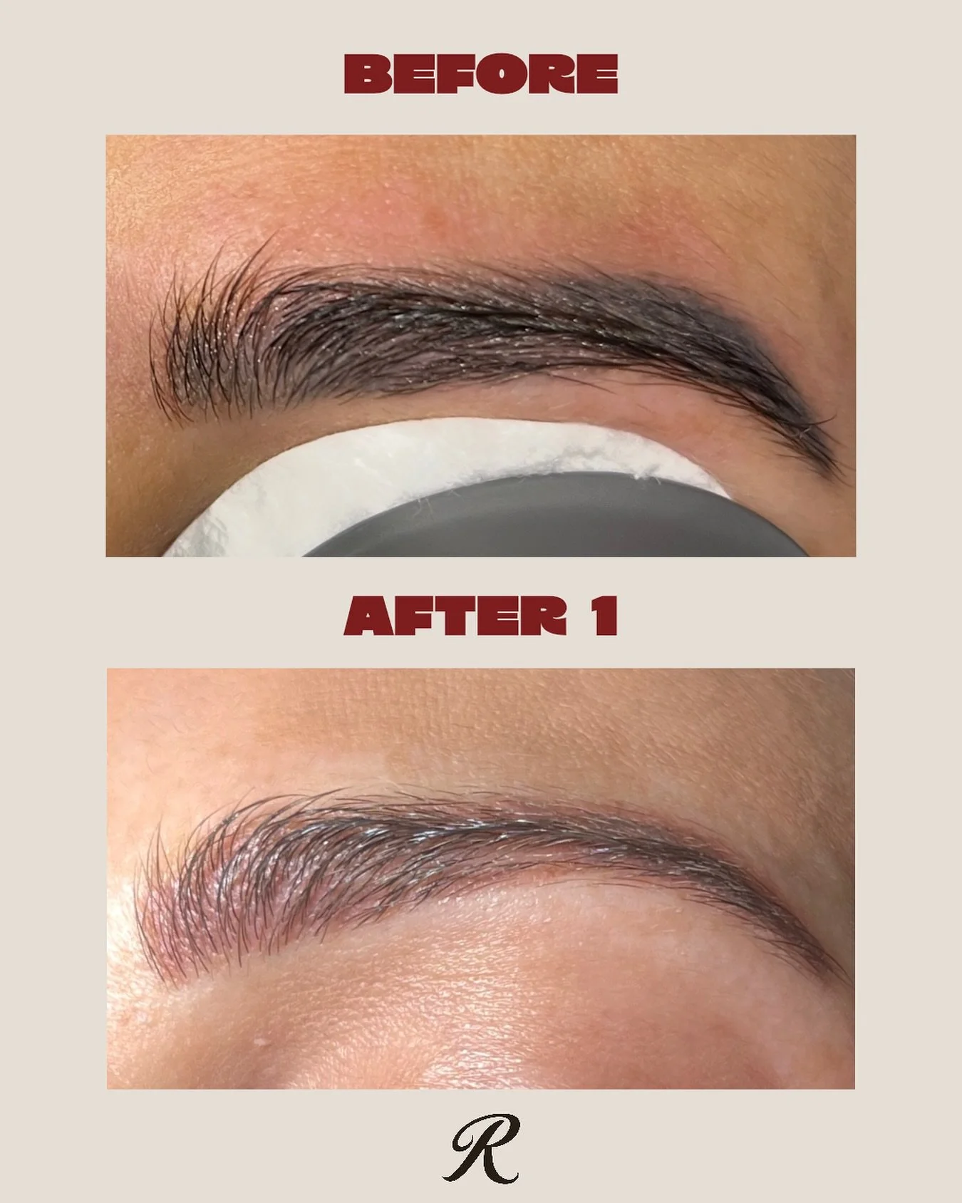 Before ➝ After | 1 treatment ✨

A significant fade after just one session - but it&rsquo;s important to understand that cosmetic brow tattoo removal can be a process for some clients. 

Cosmetic ink is made up of different pigments which means it can