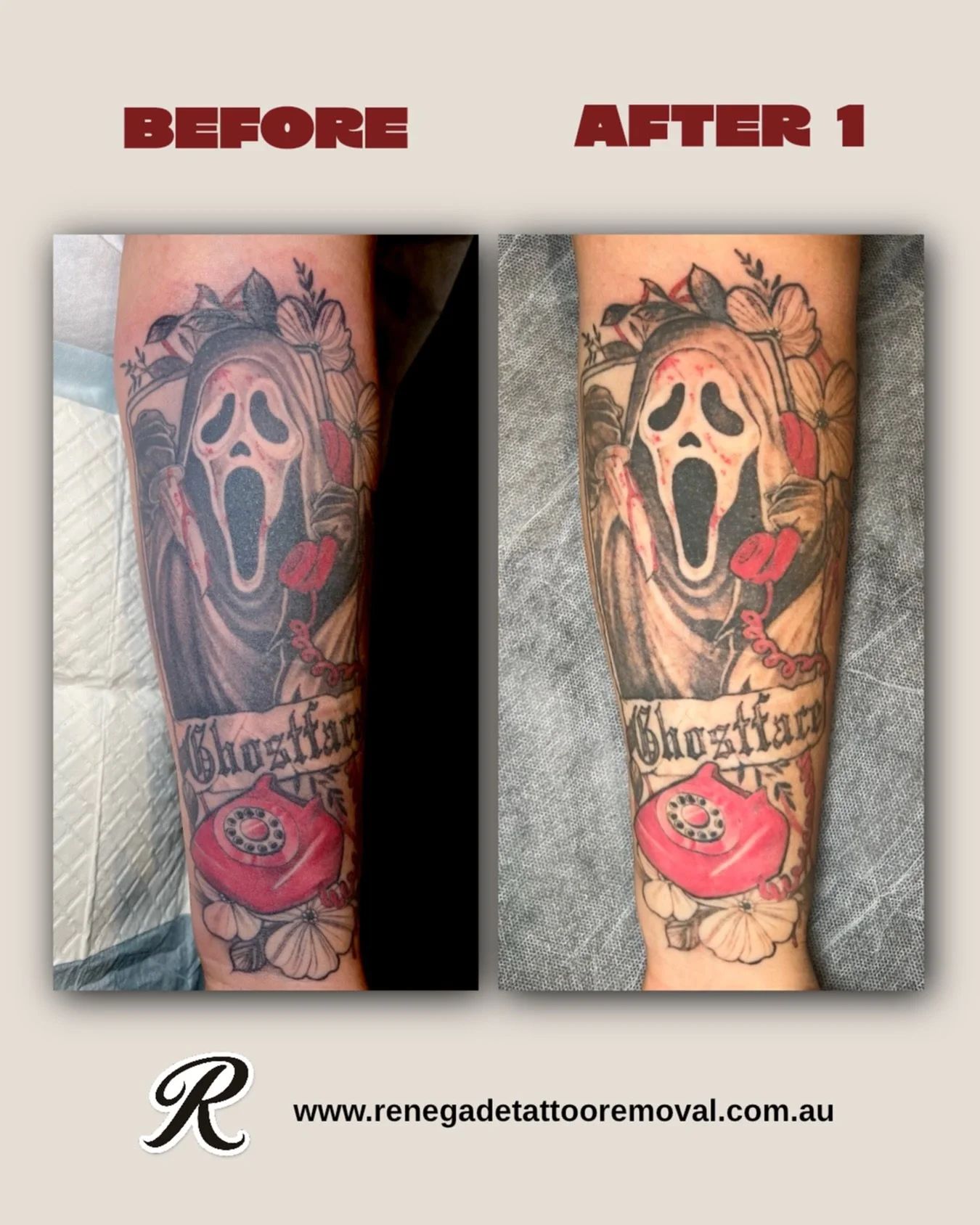 Bye grey wash 👋🏼 

Did you know the longer you leave in between sessions, the better fading you get? Our clients come in every 8-10 weeks to allow adequate fading in between sessions. 

Patience + the right approach = clean results. 

📍 North Pert