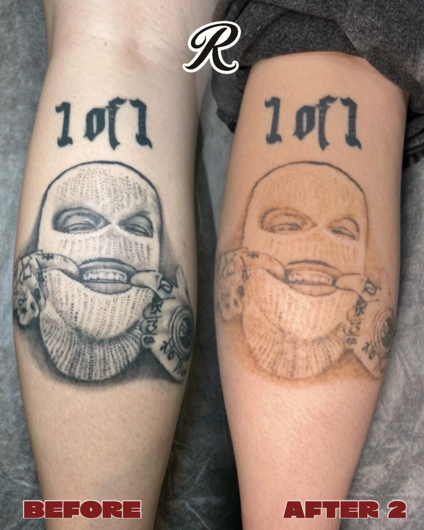 Two sessions in and this tattoo is already breaking down beautifully. 

Every tattoo responds differently, but consistency and correct treatment intervals make all the difference ⚡️

📍 North Perth | AE Studio
📲 0466 022 962
🔗 www.renegadetattoorem