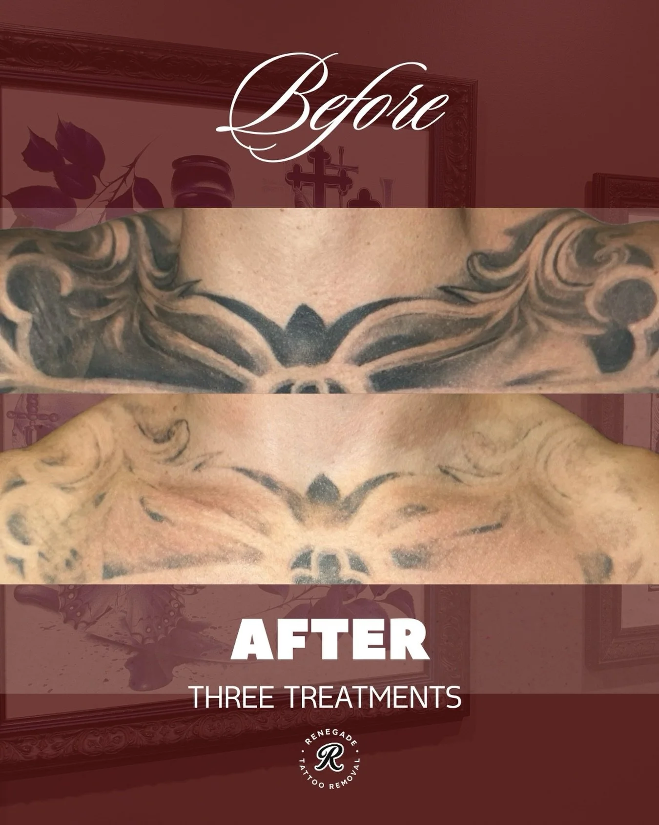 Three treatments down and the finish line is in sight 😌

This is one of those tattoos where you can really appreciate just how much has changed when you compare the before and after side by side.

Message us now for your free quote ⚡️

📍 North Pert