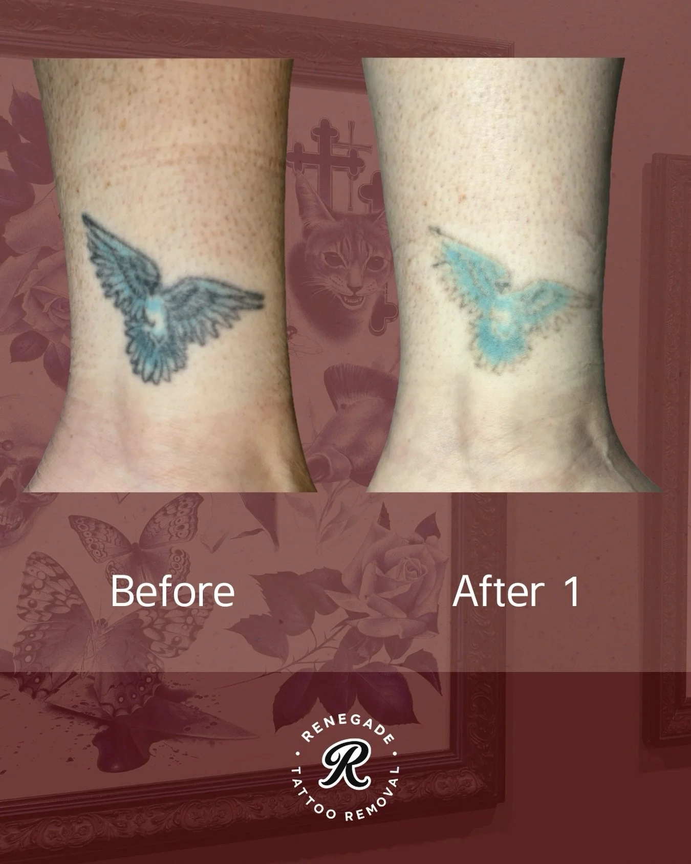 Not all of it has to go 😌

We&rsquo;re fading this one down for a cover-up, while intentionally leaving most of the blue to be incorporated into her new tattoo. 

Take advantage of our First Birthday Sale and get started this September or October.

