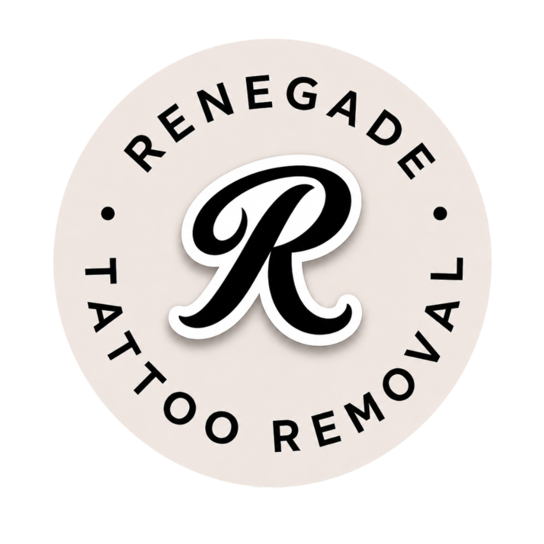 Renegade Tattoo Removal