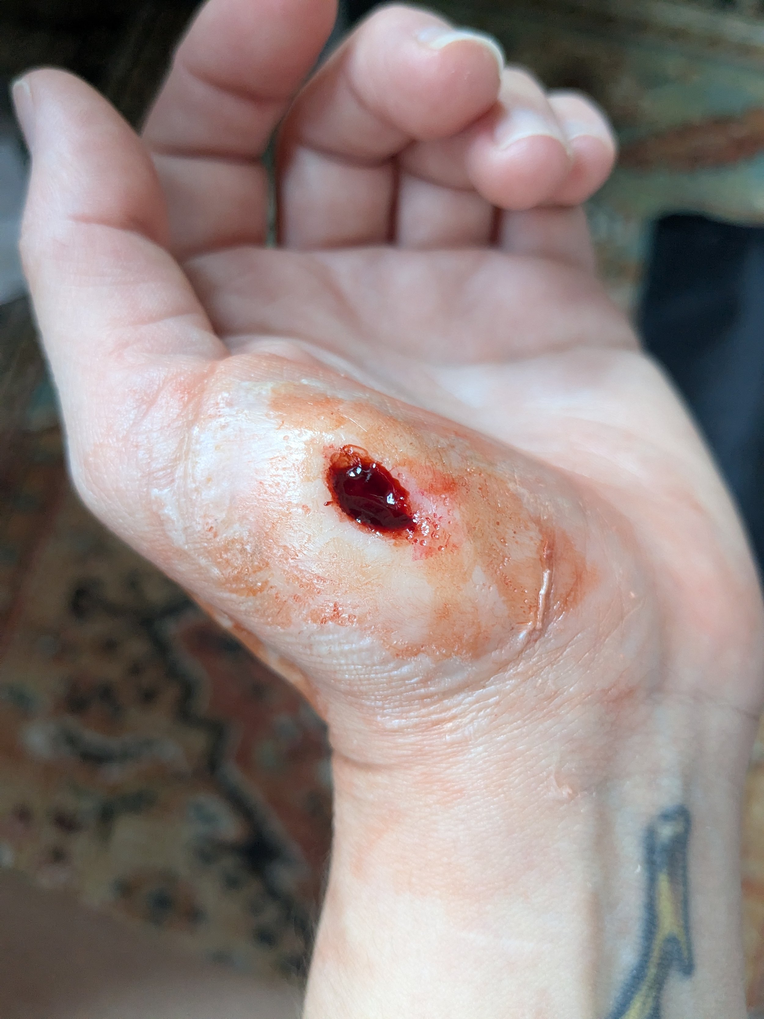 Personal project dog bite silicone prosthetic.
Sculpted molded casted applied and painted by me.