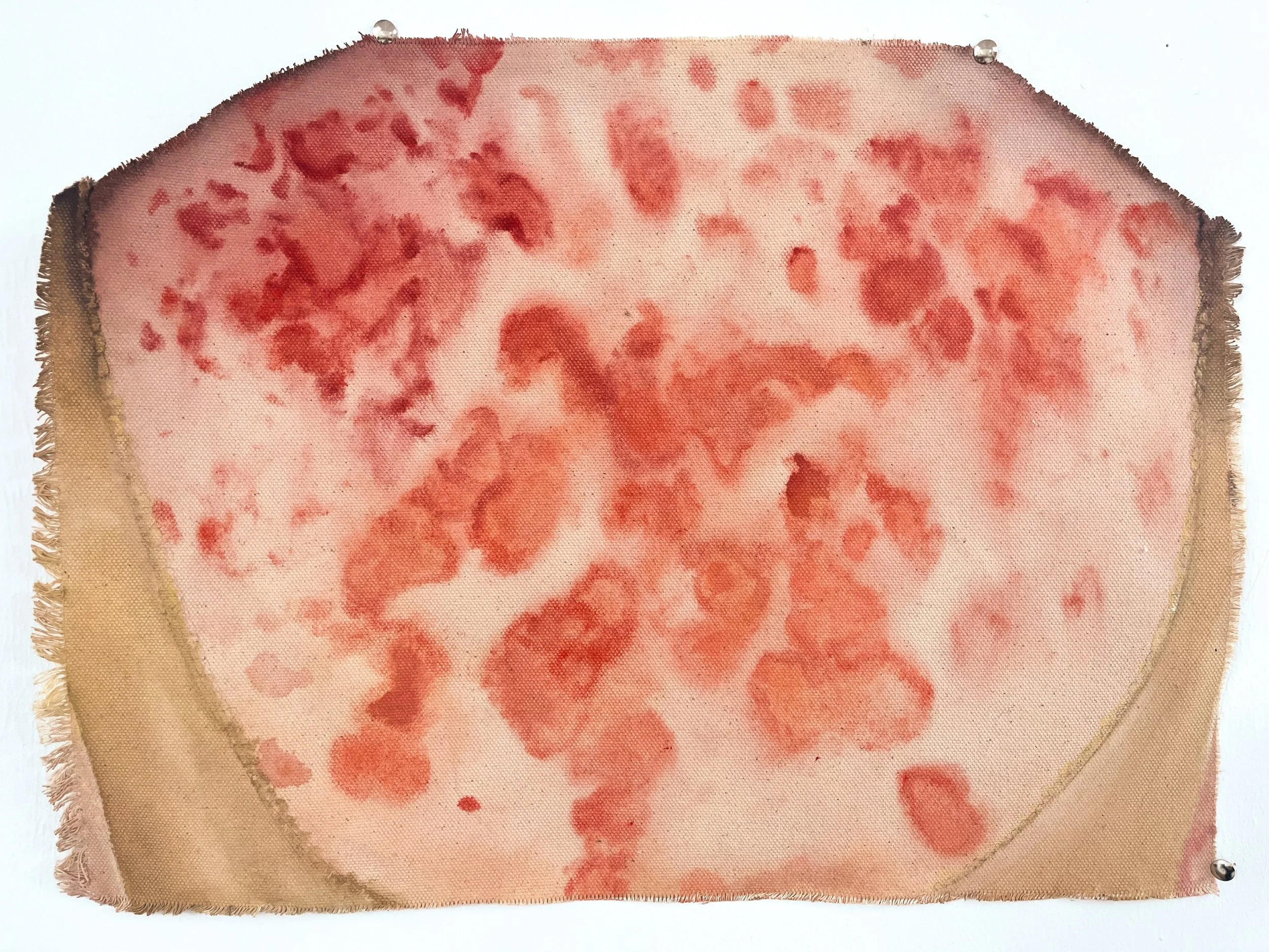 Cutaneous Lupus.jpg