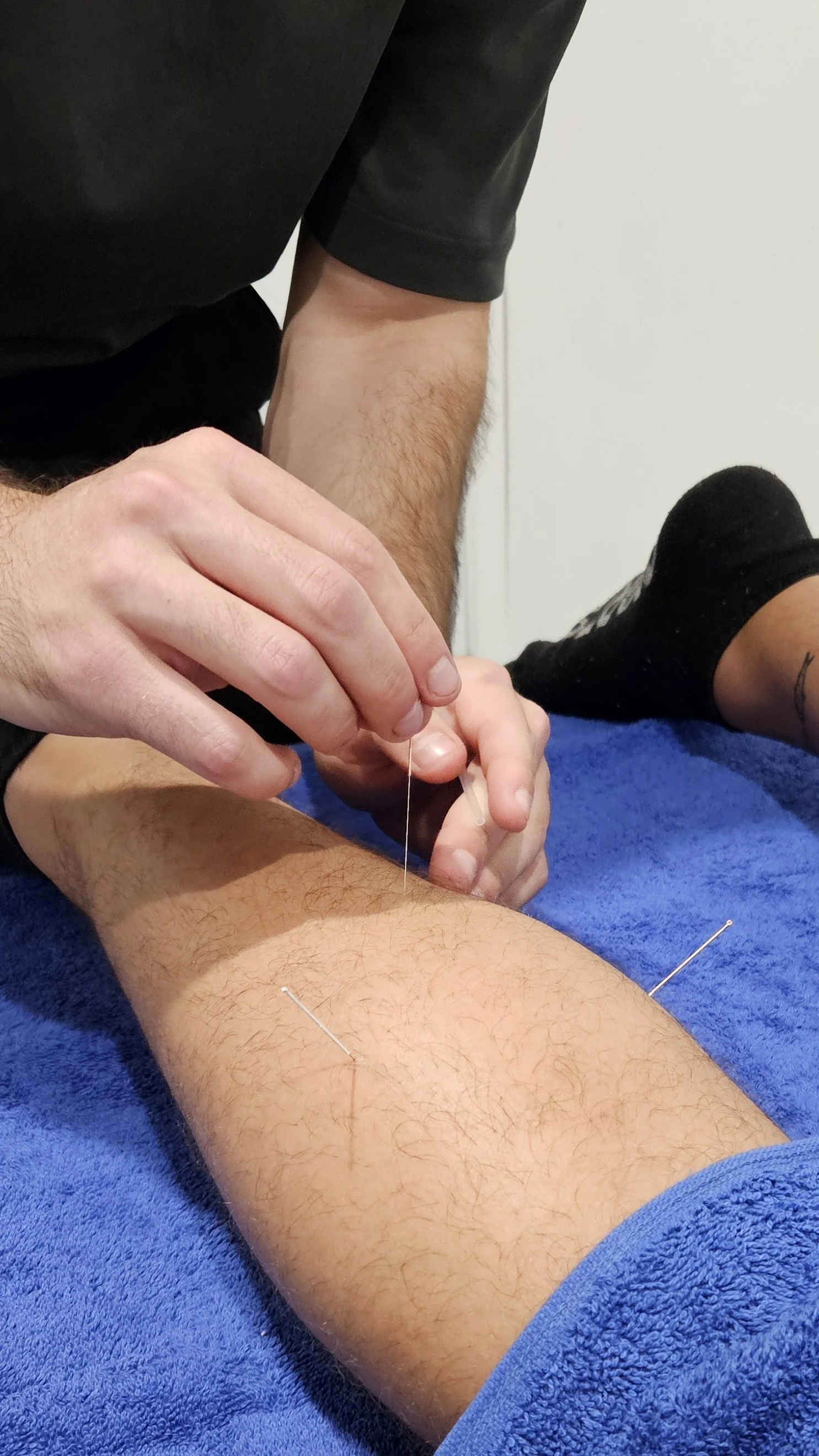 Dr Ryan Vaux Dry Needling