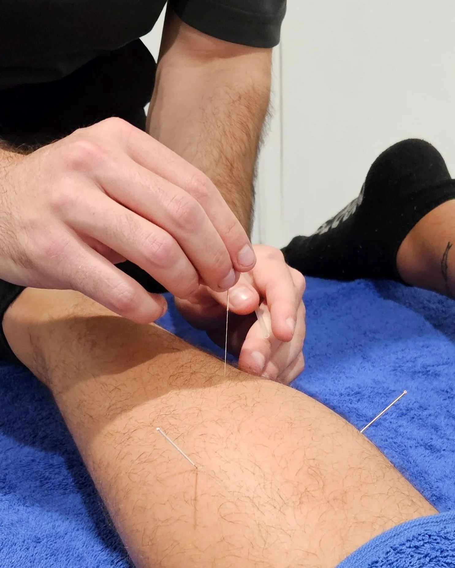 Dr Ryan Vaux dry needling