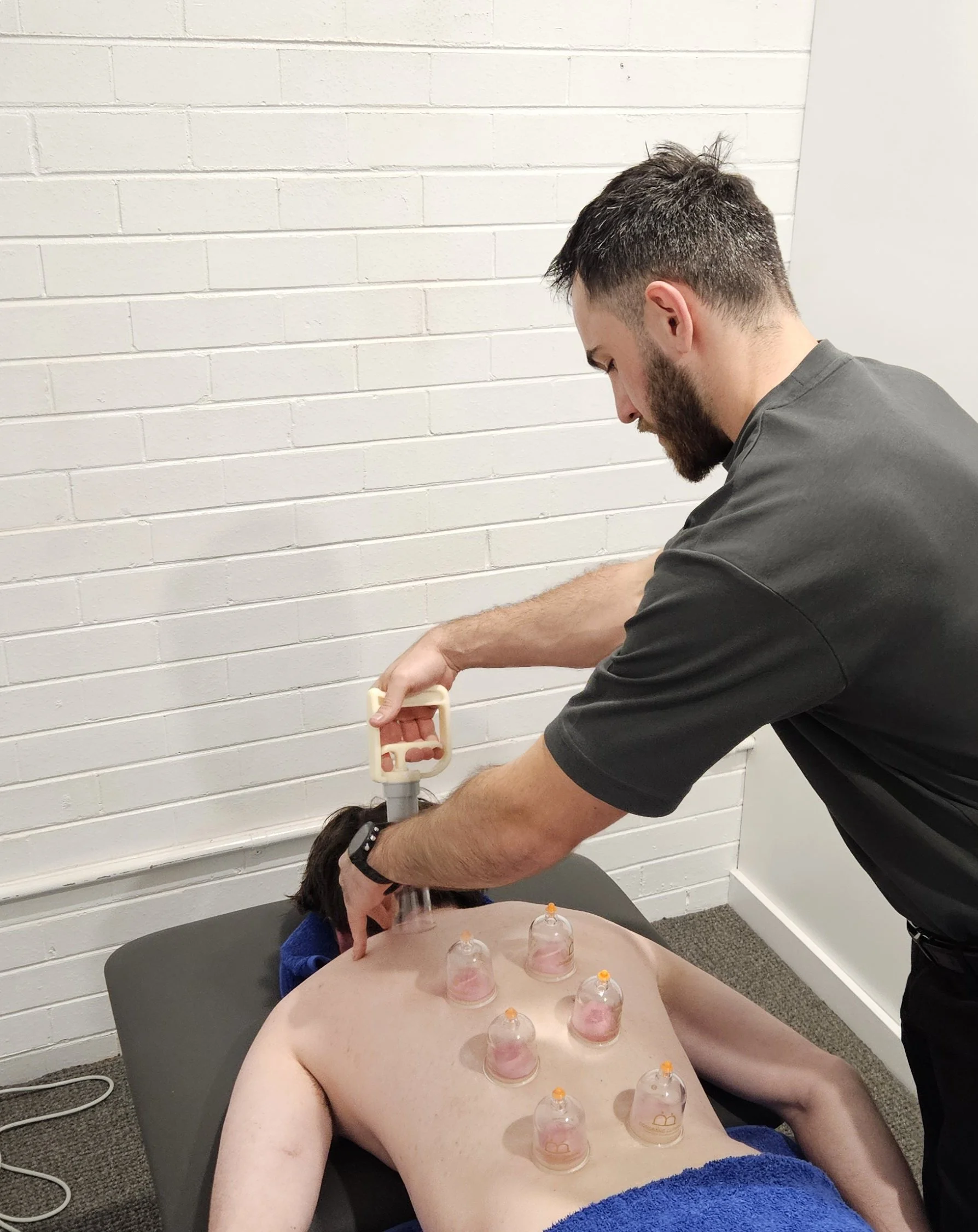 Dr Ryan Vaux cupping treatment