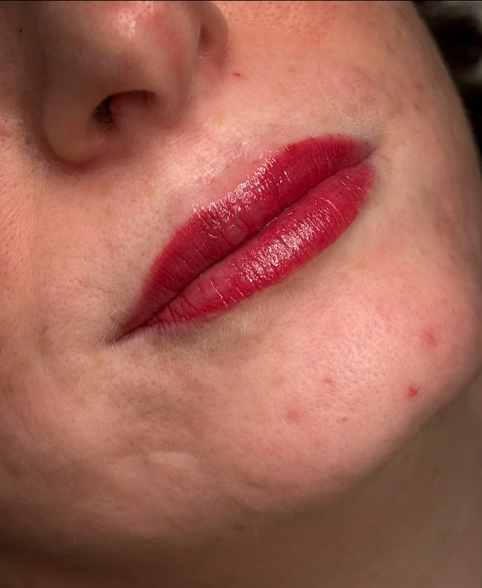 Close-up of a person's face showing a nose and lips with red lipstick, skin texture, and some facial blemishes.