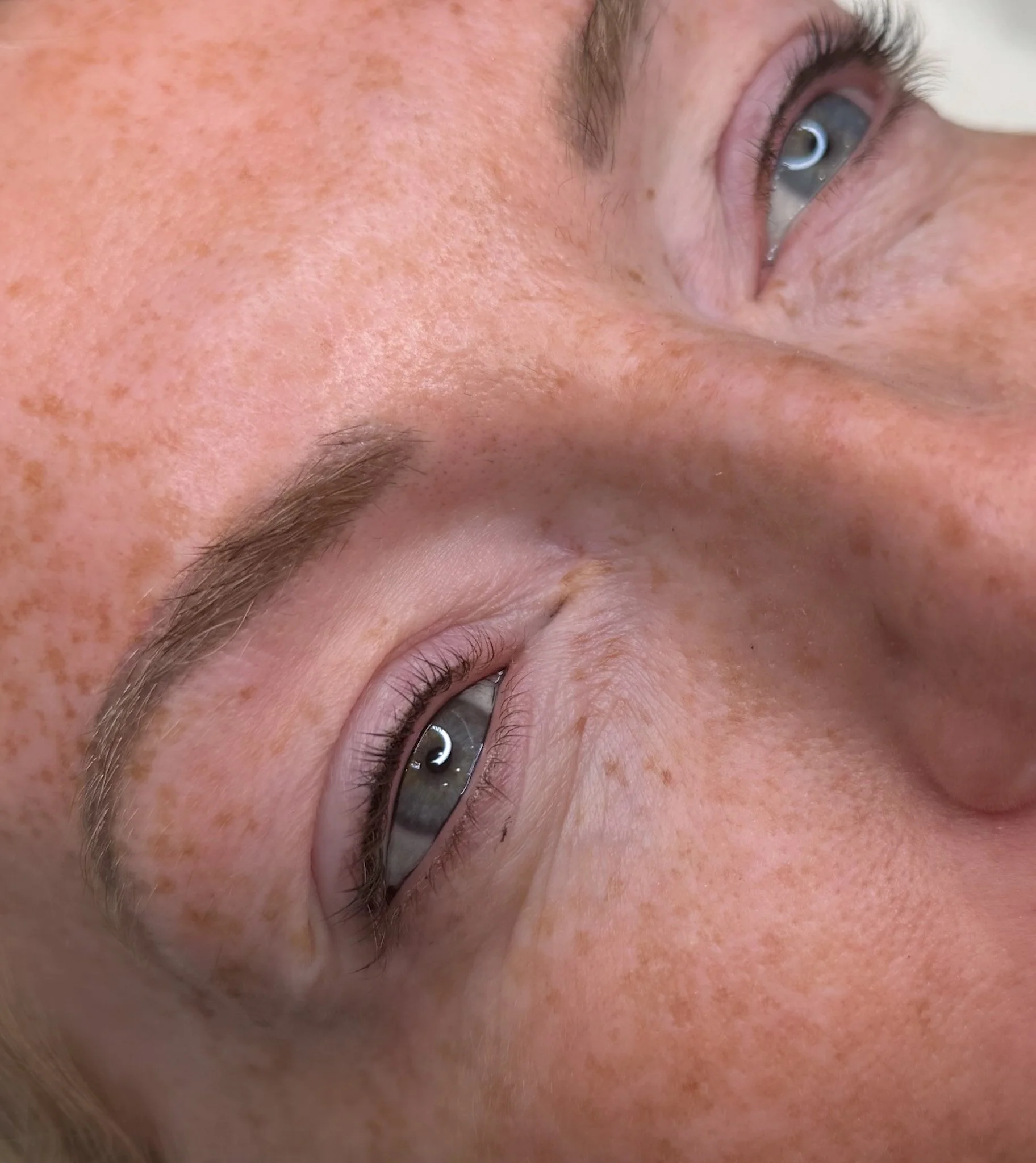 Close-up of a person's face showing their eyes, eyebrows, and skin with freckles.