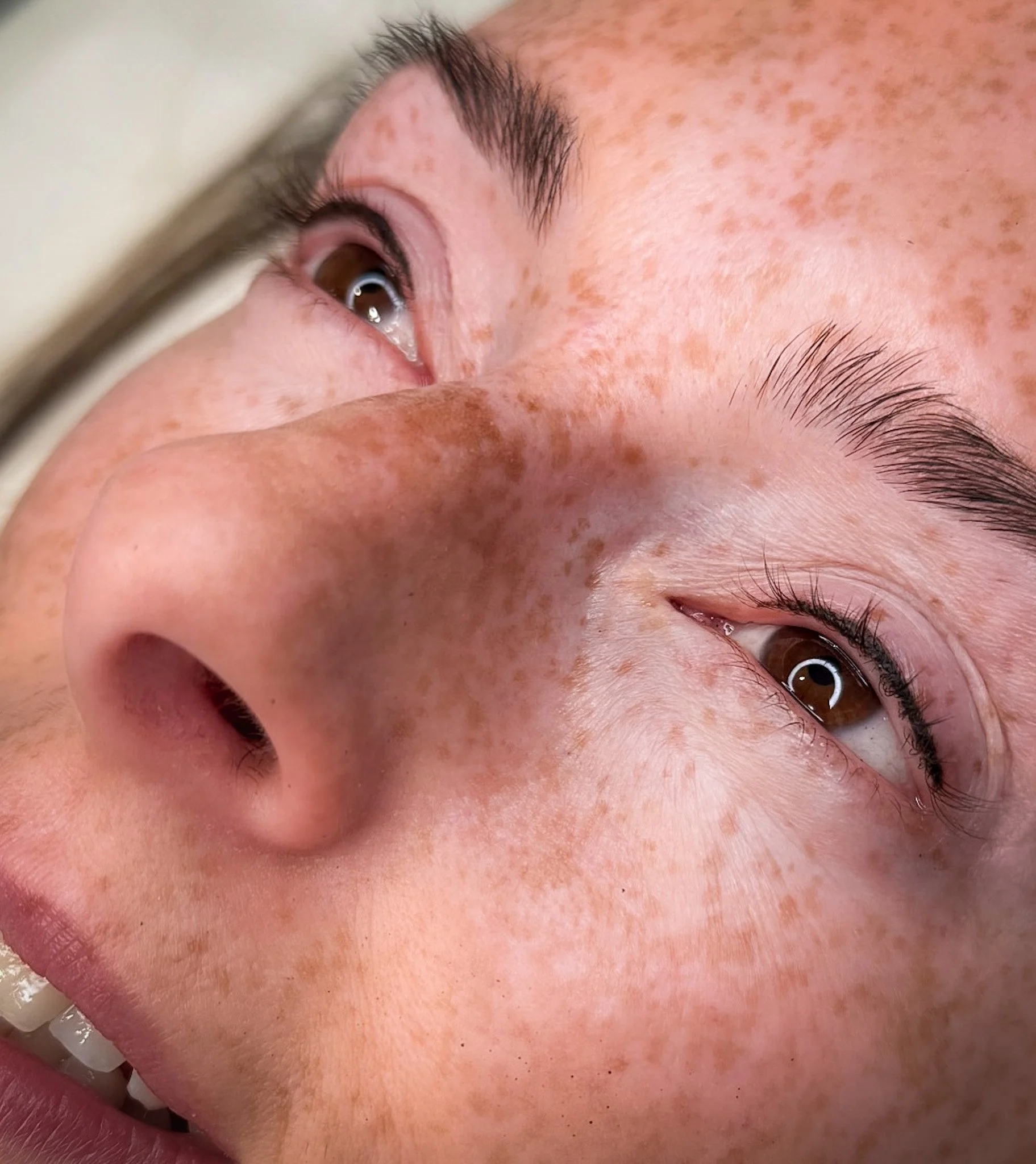 Close-up of a person's face focusing on their nose, freckles, and partially visible eye and mouth.