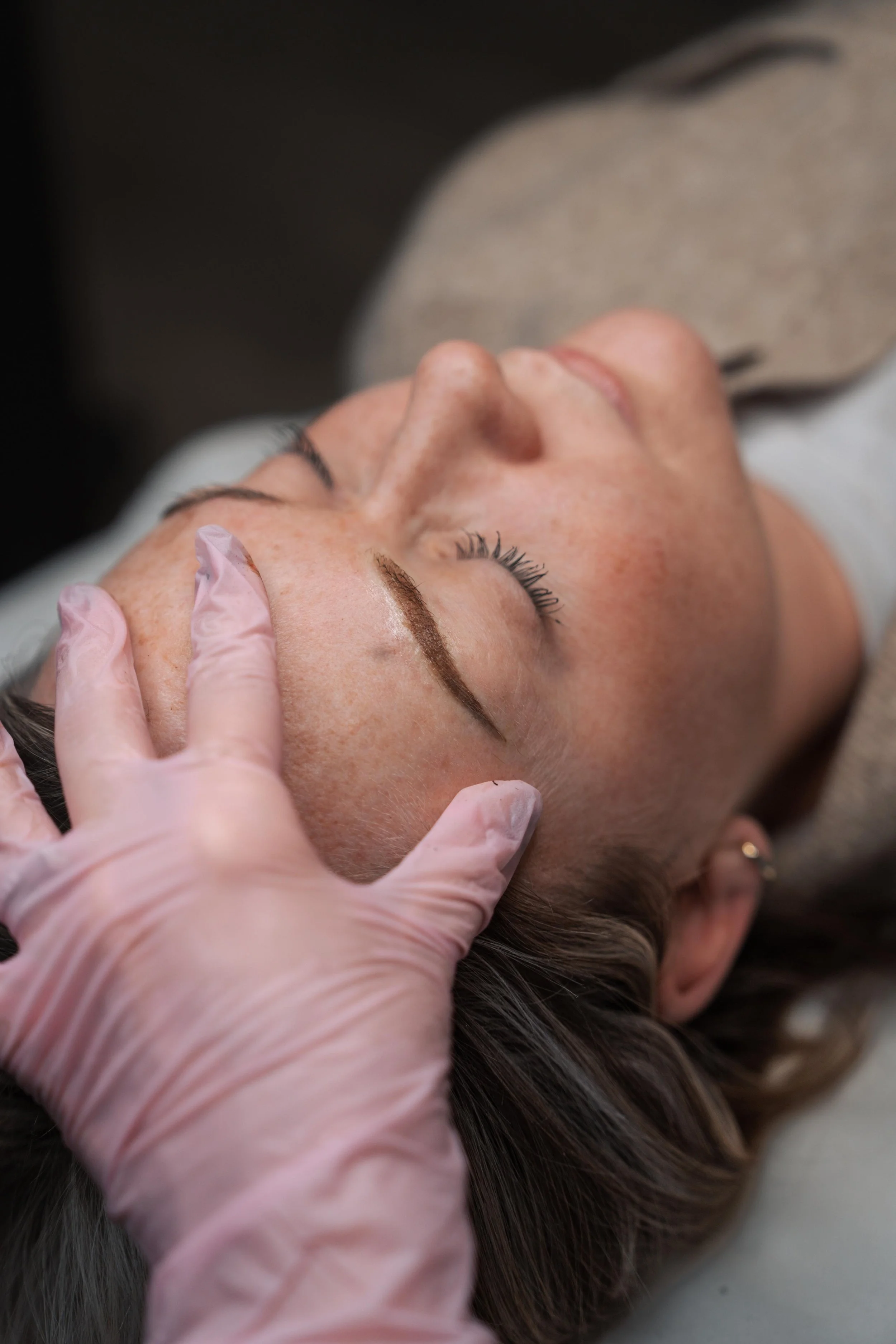 A person receiving a cosmetic or dermatological treatment on their forehead from a professional wearing gloves.