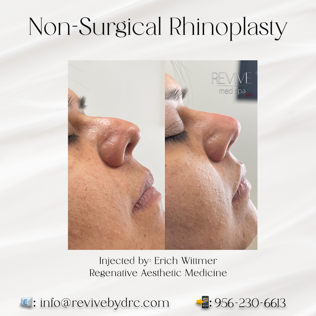 Nose by Dr.png