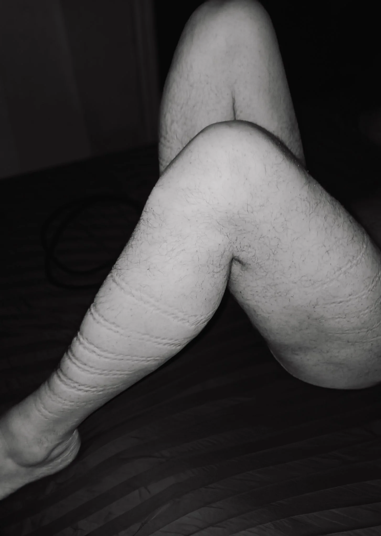 Close-up of a person's bare legs and feet with hairy skin, lying on a dark surface.