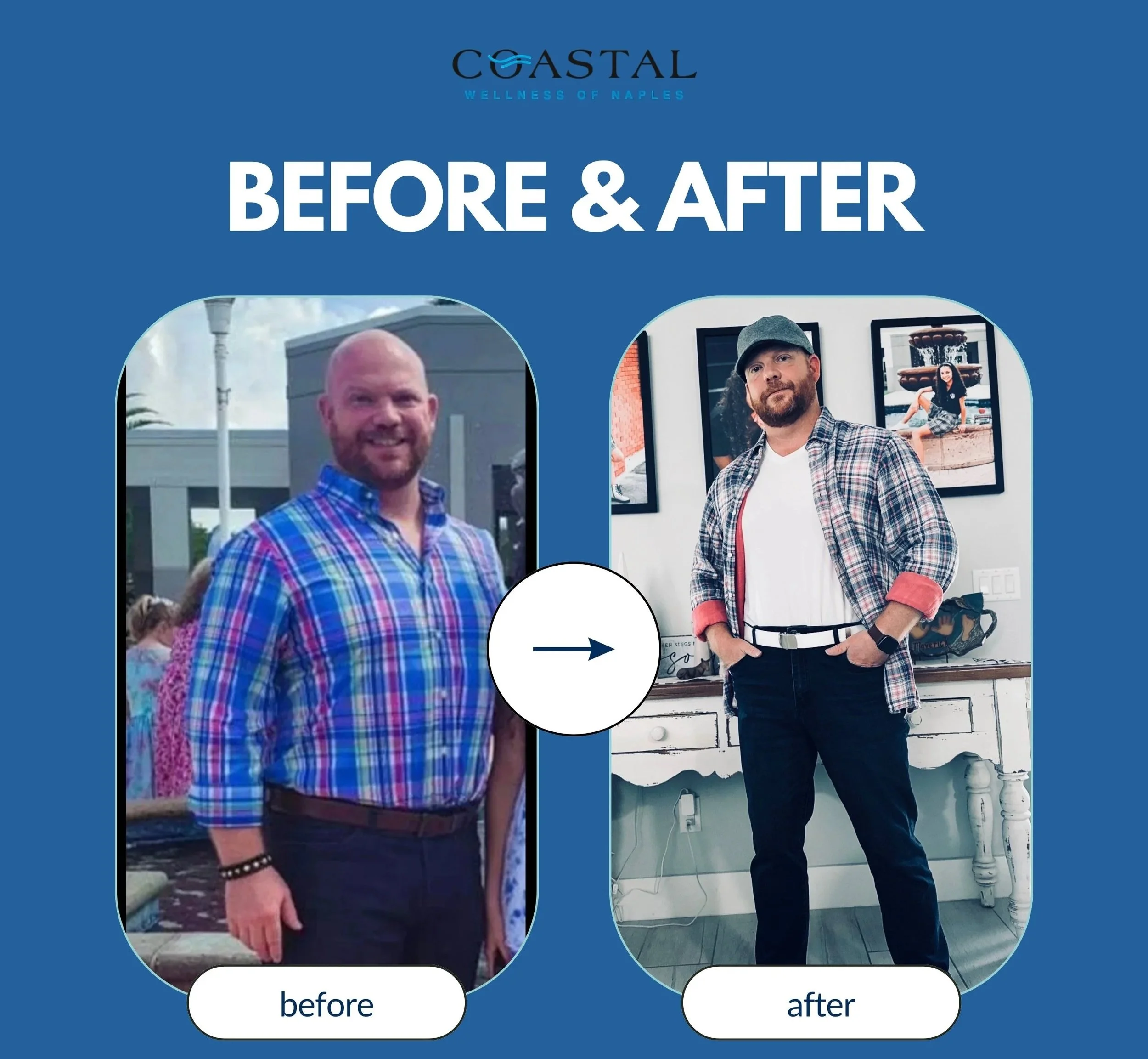 'Coastal Wellness of Naples' GLP-1 before and after of a successful weight loss client photos of a man, showing weight loss, with the text  at the top.