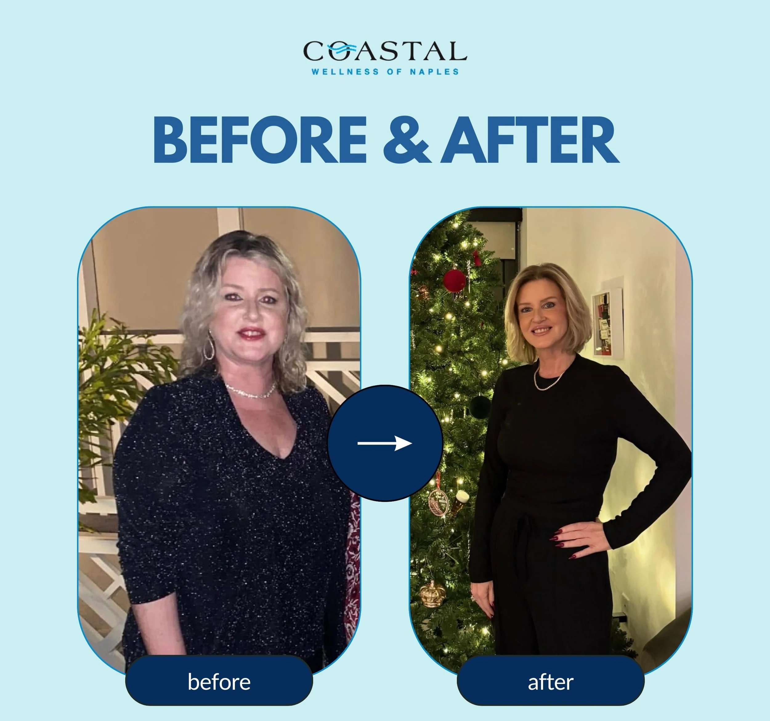 Comparison of a woman before and after a wellness treatment at Coastal Wellness of Naples, showing her in a sparkly top before and in a black outfit with a Christmas tree after.