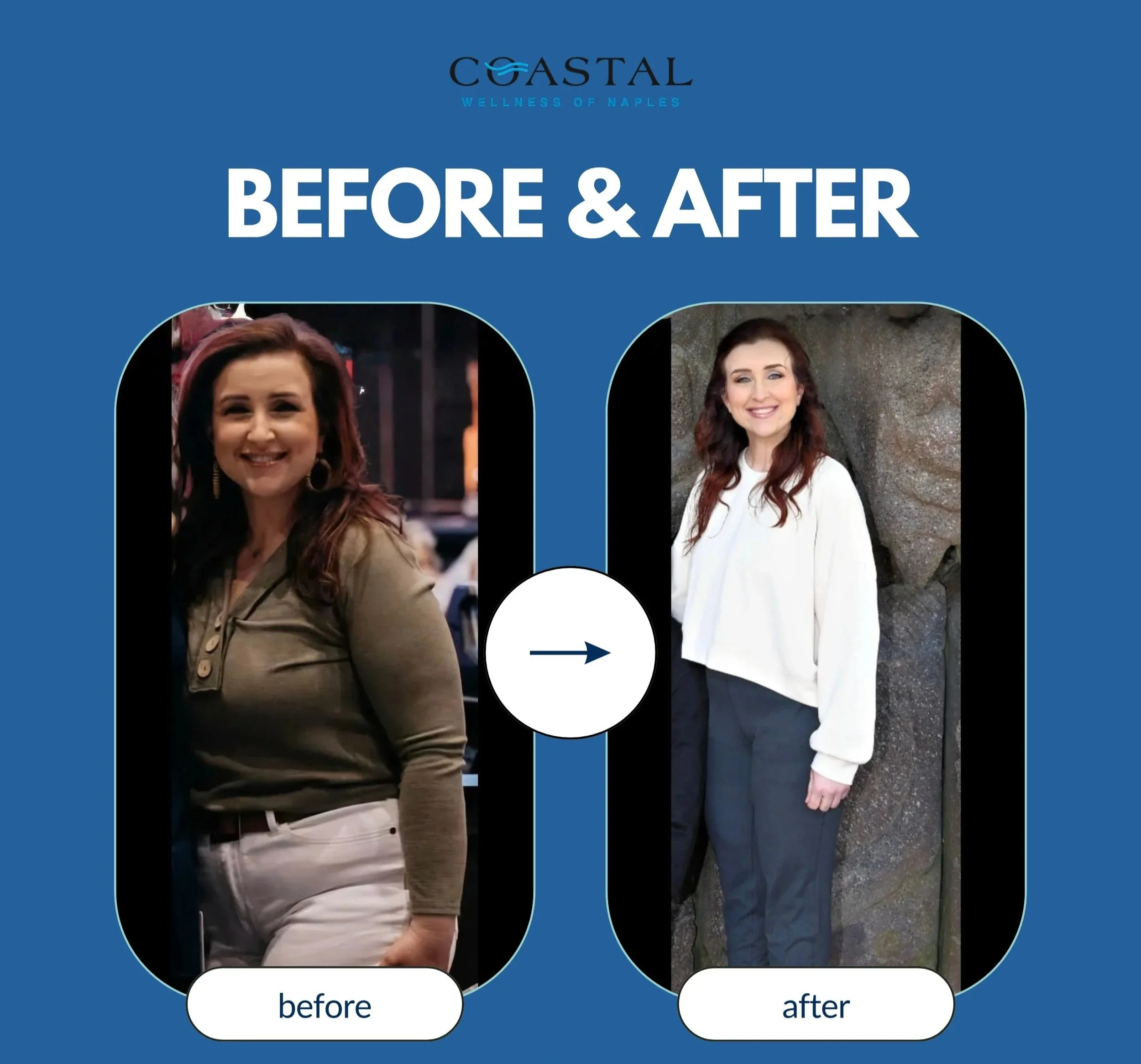 A side-by-side comparison of a woman before and after a wellness or beauty treatment, showing her smiling in both photos, with the 'before' on the left and 'after' on the right, against a blue background with the text 'BEFORE & AFTER' and the logo 'C