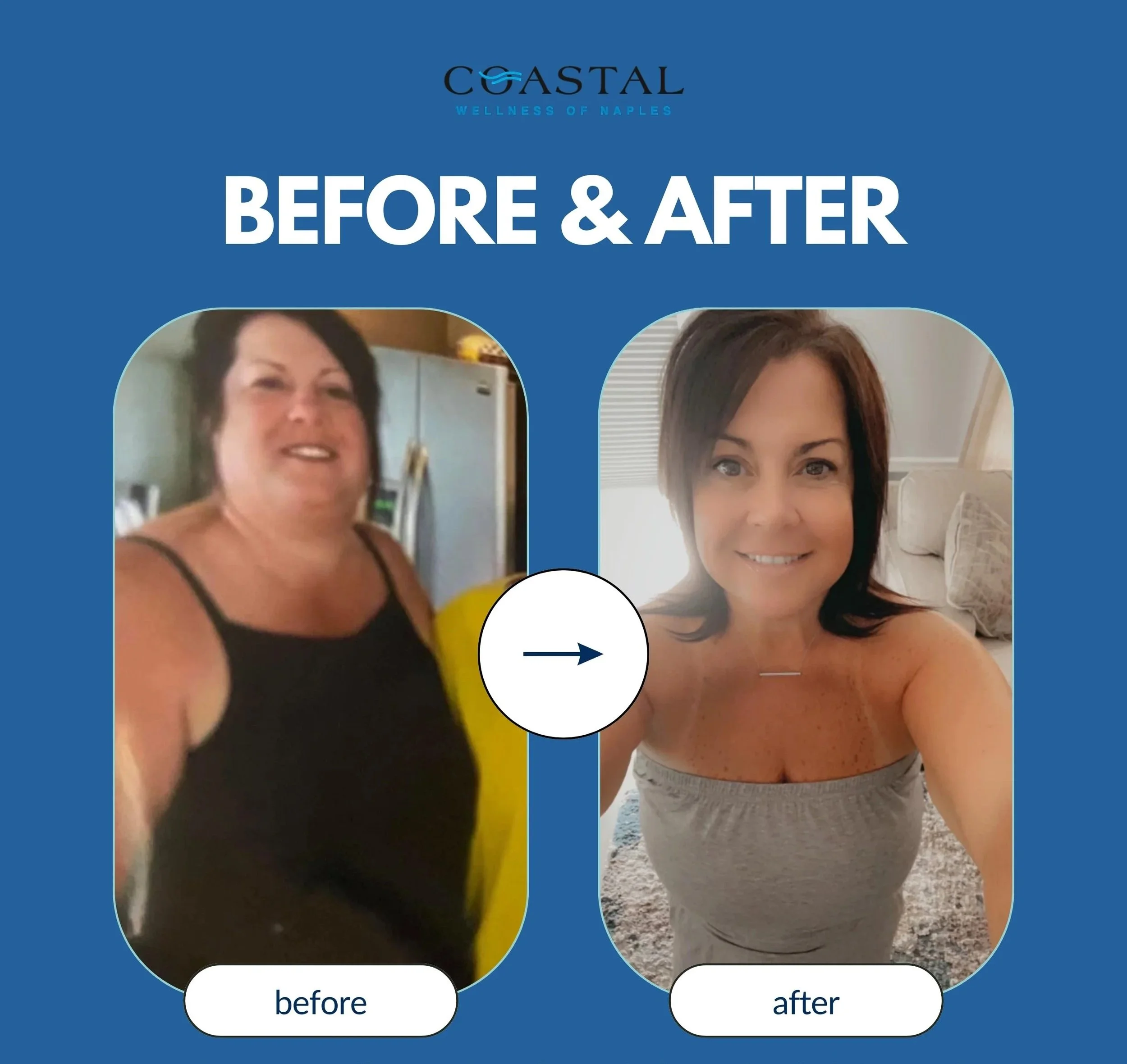 Side-by-side comparison of a woman before and after weight loss, with the before image showing her with a larger figure and the after image showing her with a slimmer physique, on a blue background with the text 'Before & After'.