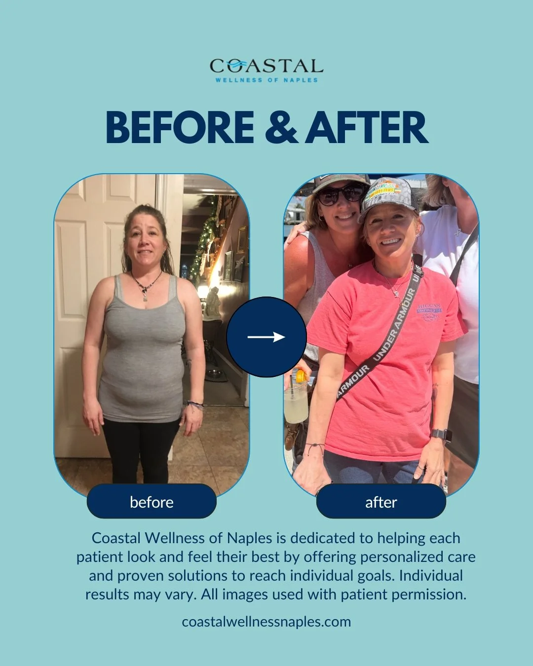 Side-by-side comparison of a woman's before and after photos. In the before photo, she is standing indoors wearing a gray tank top and black pants, looking at the camera with a neutral expression. In the after photo, she is outside with two other women, smiling, wearing a pink T-shirt, sunglasses, and a baseball cap, appearing happier and more energetic.