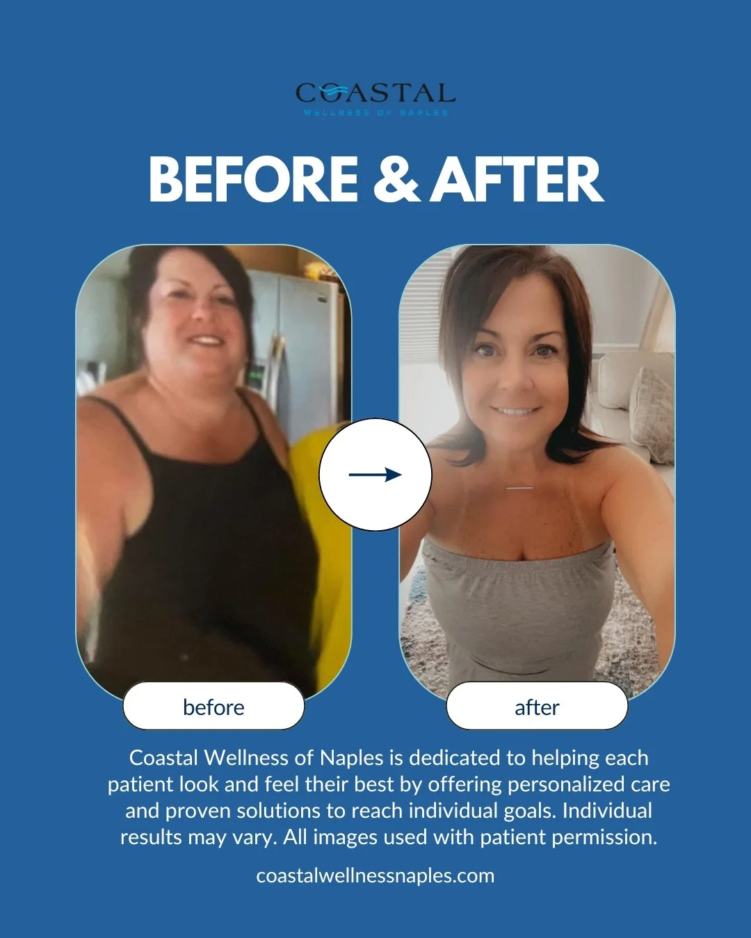 Before and after photos of a woman showing weight loss, with a blue background and text indicating it's from Coastal Wellness of Naples. The first photo shows a woman with dark hair in a black top, and the second shows her with shorter hair and a lighter top, smiling. There is an arrow pointing from the before to the after photo, and the text mentions personalized care and reaching individual health goals.