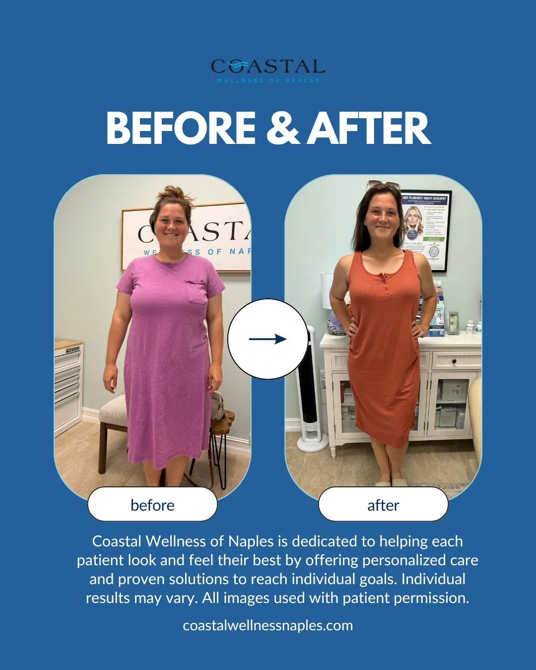 Side-by-side before and after photos of a woman at Coastal Wellness of Naples showing her weight loss or body transformation. The left photo shows her in a purple dress before treatment, and the right photo shows her in an orange dress after treatment, smiling confidently.