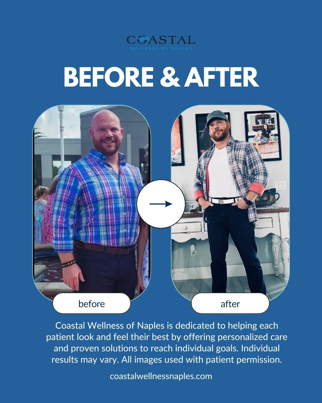 Side-by-side before and after photos of a man showing weight loss. The before photo shows him with a fuller face and body, wearing a blue plaid shirt, at an outdoor event. The after photo shows him slimmer, with a beard and wearing a cap, plaid shirt over a white T-shirt, indoor setting with framed photos on the wall.