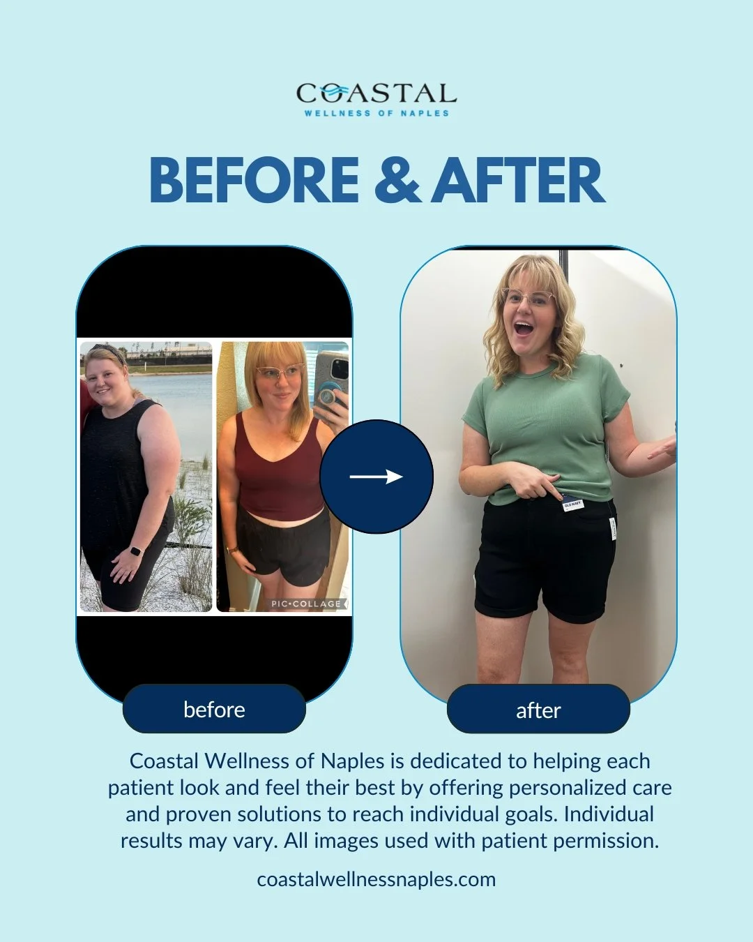 Side-by-side comparison of a woman before and after weight loss, with the negative and positive photos on the left and a happy, slim woman on the right. The image promotes Coastal Wellness of Naples' personalized care for reaching individual health goals.