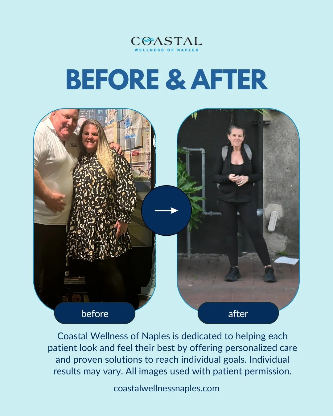 Before and after images showing a woman's fitness transformation at Coastal Wellness of Naples, with the before photo on the left of a woman with a man, and the after photo on the right of the woman standing alone outdoors.