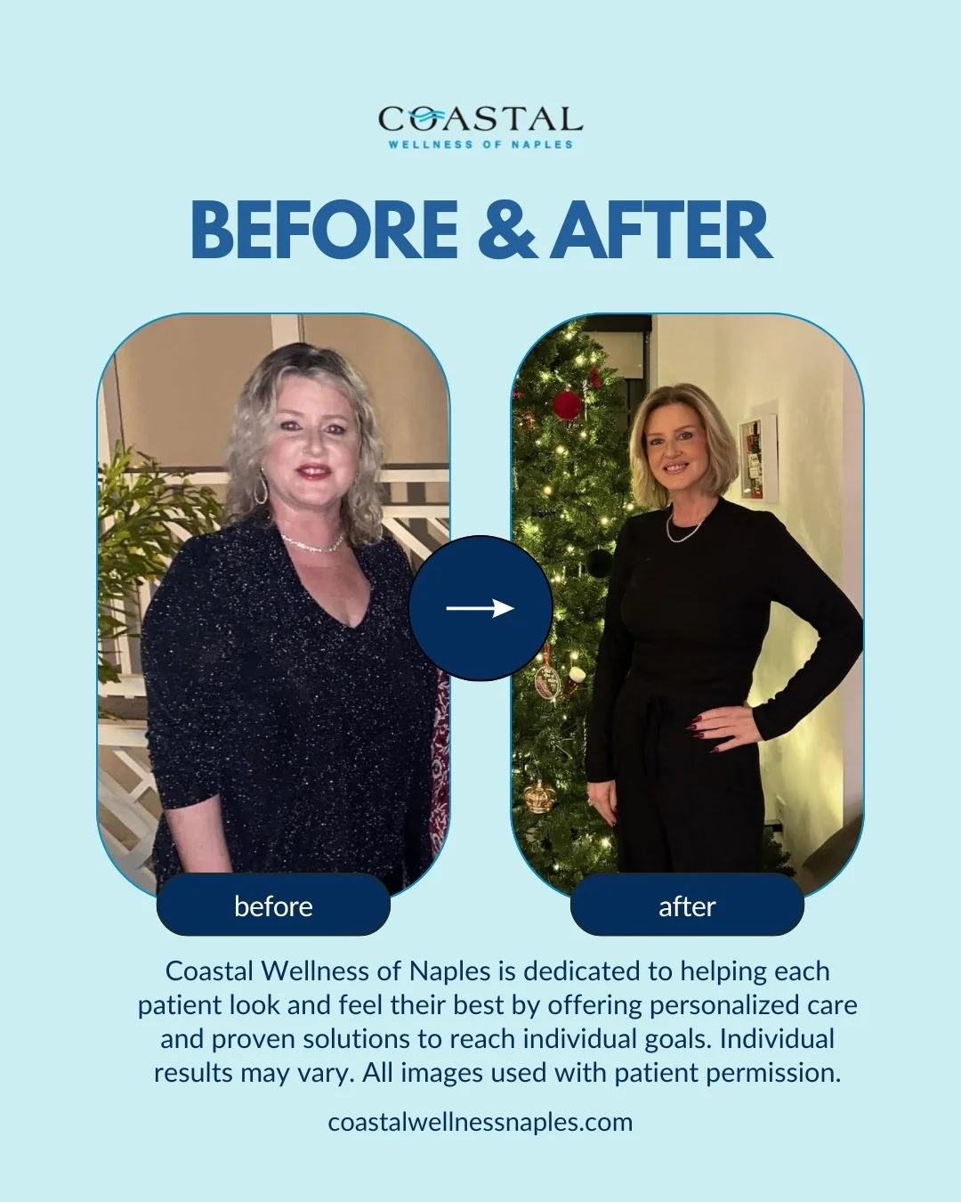 Side-by-side before and after photos showing a woman's weight loss. In the before photo, she has blonde curly hair, is wearing a sparkly black top, and is standing near a plant. In the after photo, she has shoulder-length blonde hair, is wearing a black top and pants, with a Christmas tree in the background.