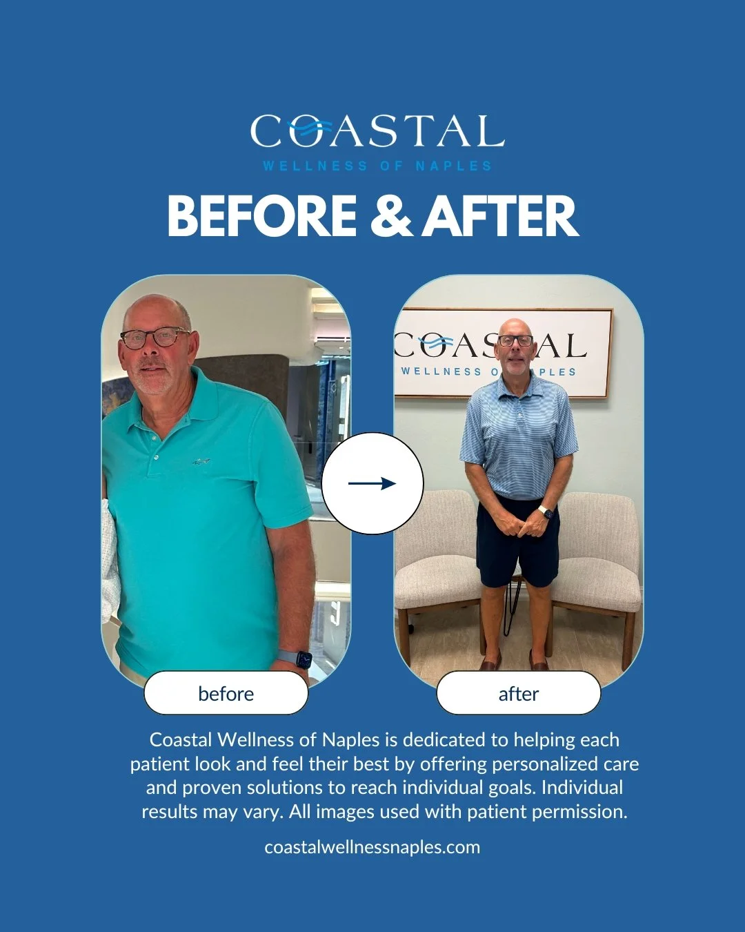 A side-by-side before and after photo of a man in a blue shirt, showing physical transformation at Coastal Wellness of Naples. The left image depicts the man before the treatment, and the right image shows him after the treatment with a more fit appe