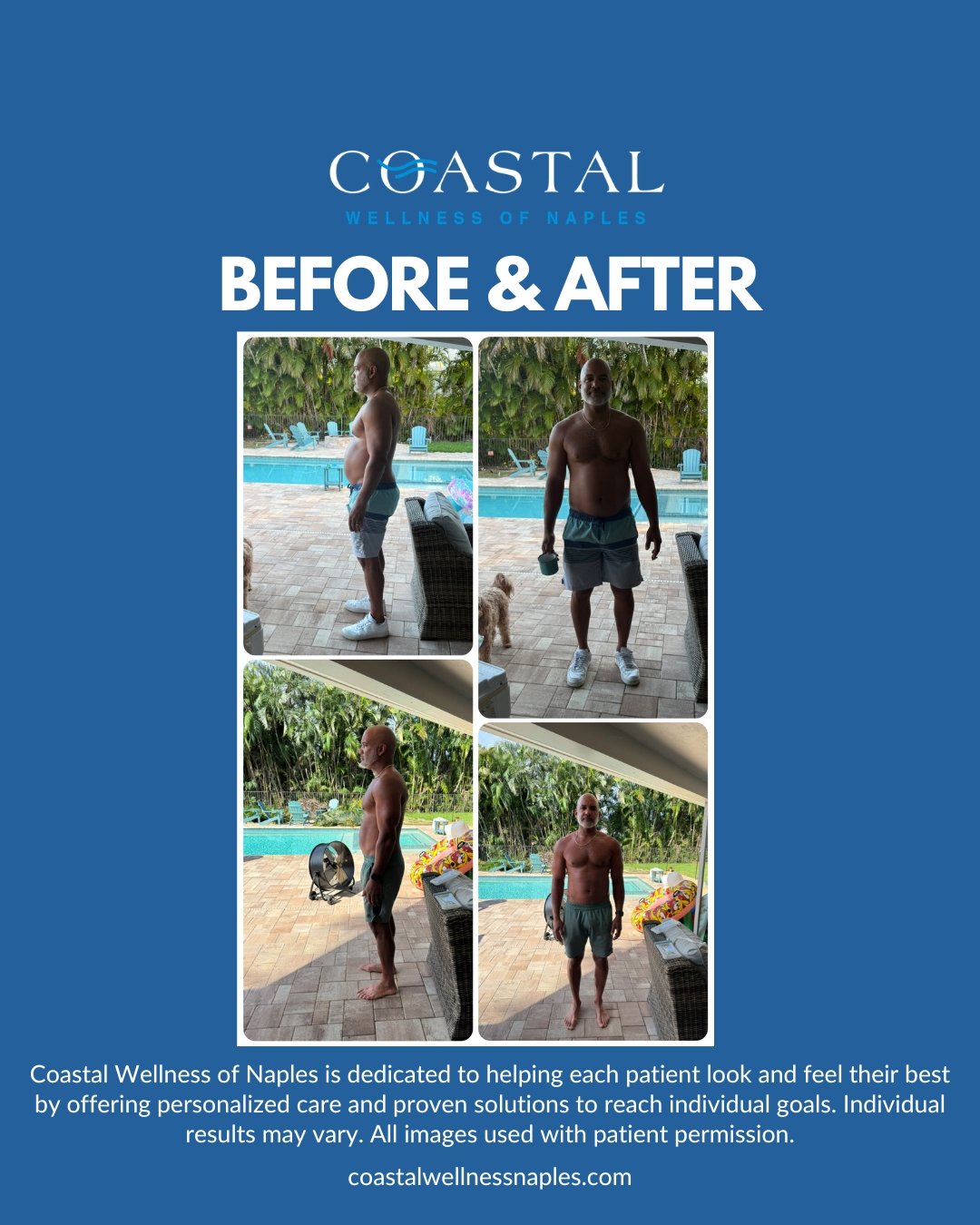 Before and after photos showing a man’s fitness transformation. In the 'before' photos, he appears heavier with a larger belly, and in the 'after' photos, he looks leaner with a more defined physique. The setting is an outdoor patio by a pool, with l