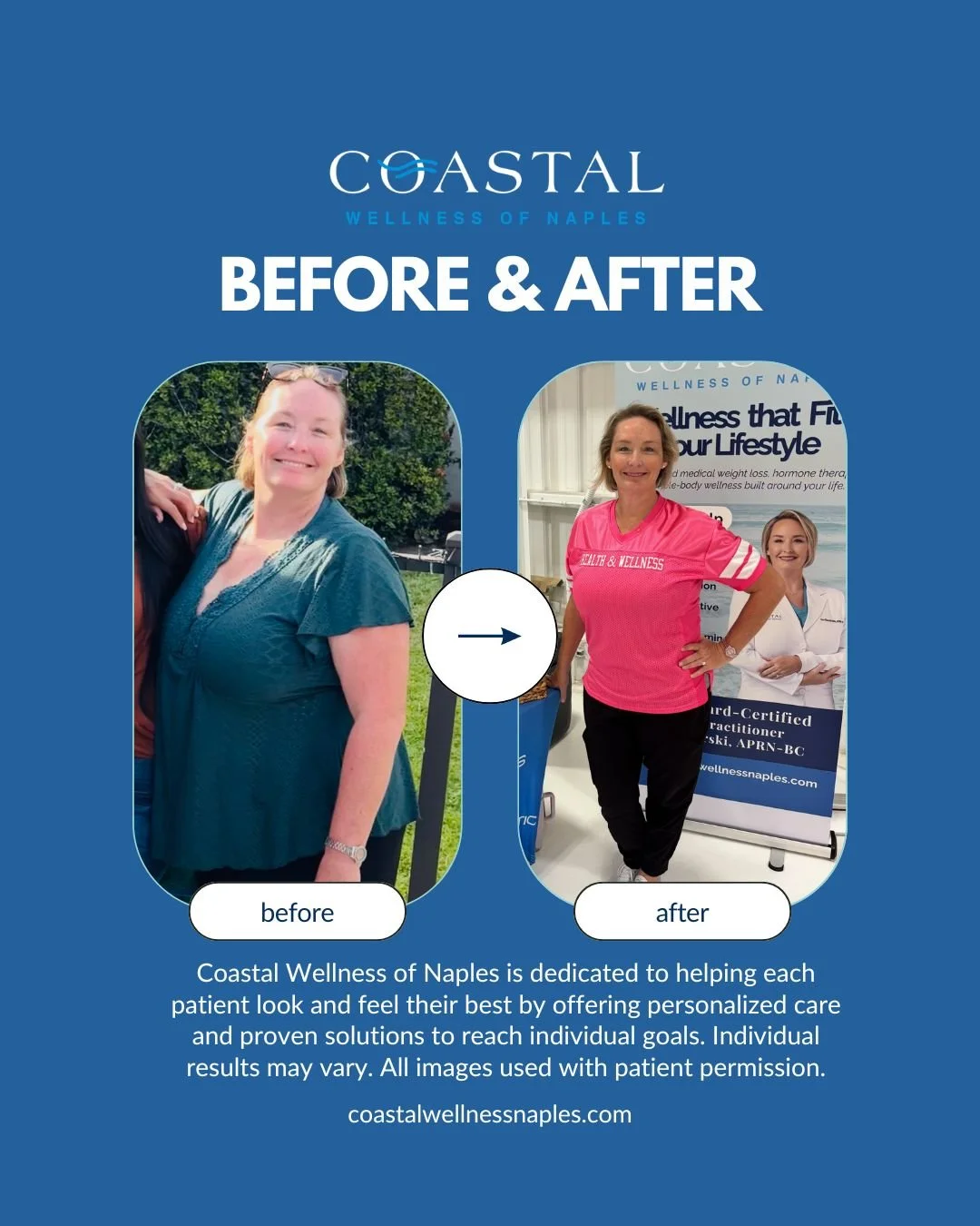 Comparison of a woman before and after weight loss at Coastal Wellness of Naples, showing improved health and appearance.