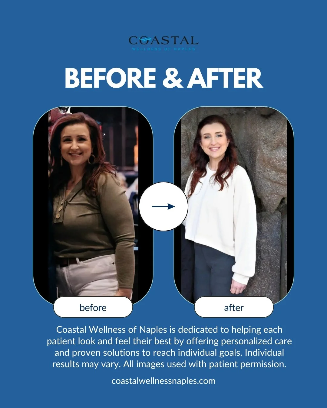 A side-by-side comparison of a woman before and after a wellness treatment. The before photo shows the woman with long reddish-brown hair, wearing a beige top and white pants, smiling. The after photo shows her with longer hair, styled more neatly, wearing a white top and dark pants, also smiling. The background of the before photo appears to be an indoor setting, while the after photo features a natural rocky backdrop. The text indicates it is an advertisement for Coastal Wellness of Naples, specializing in personalized care to help patients look and feel their best.
