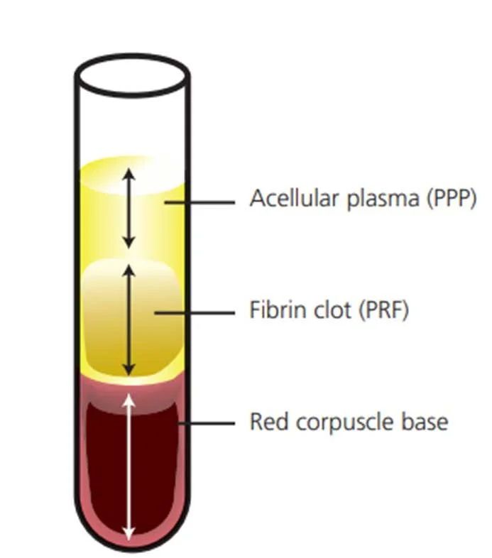 Diagram of a blood clotting test tube showing three layers: red blood cell layer at the bottom, fibrin clot layer in the middle, and acellular plasma layer at the top.