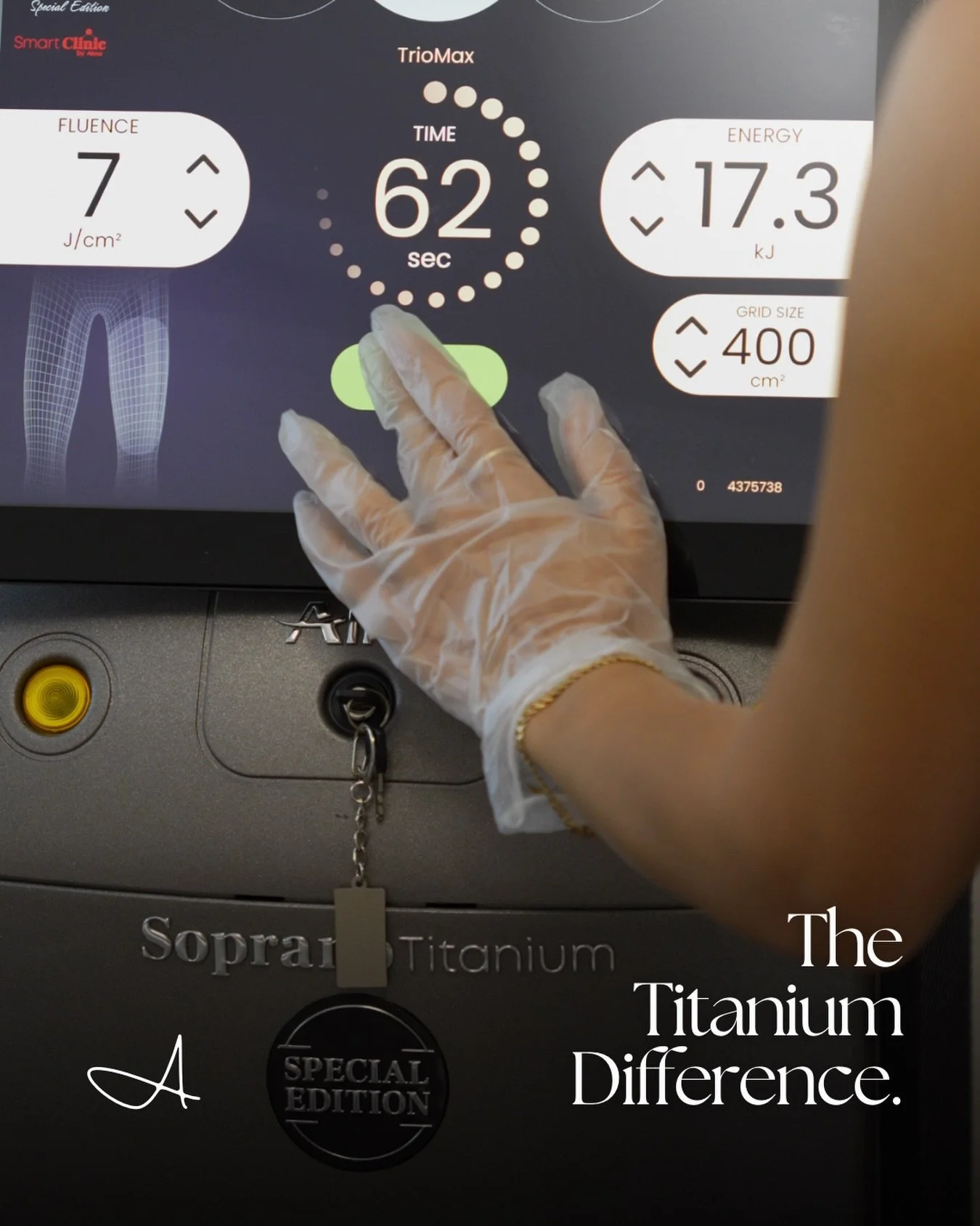 Meet the Soprano Titanium. The technology behind precise laser treatment. Advanced cooling keeps each session smooth, so the only thing you notice is the result. This is laser, done properly ❄️

&bull;⁠
&bull;⁠
&bull;⁠
Laser Hair Removal Melbourne⁠
A