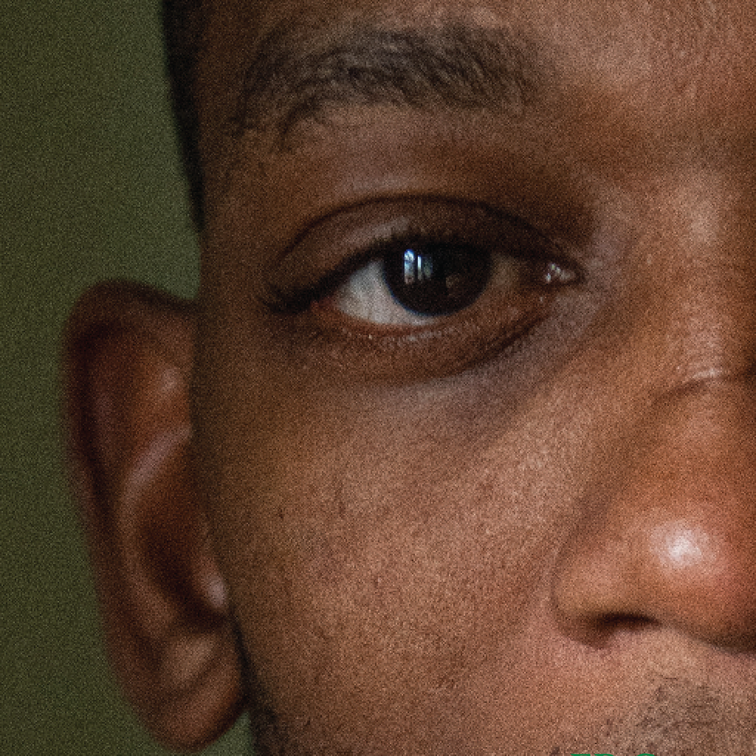 Close-up of a person's face, focusing on the right eye and ear, with a dark background.