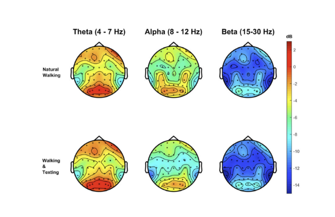 New Offering: Quantitative Electroencephalogram (QEEG)