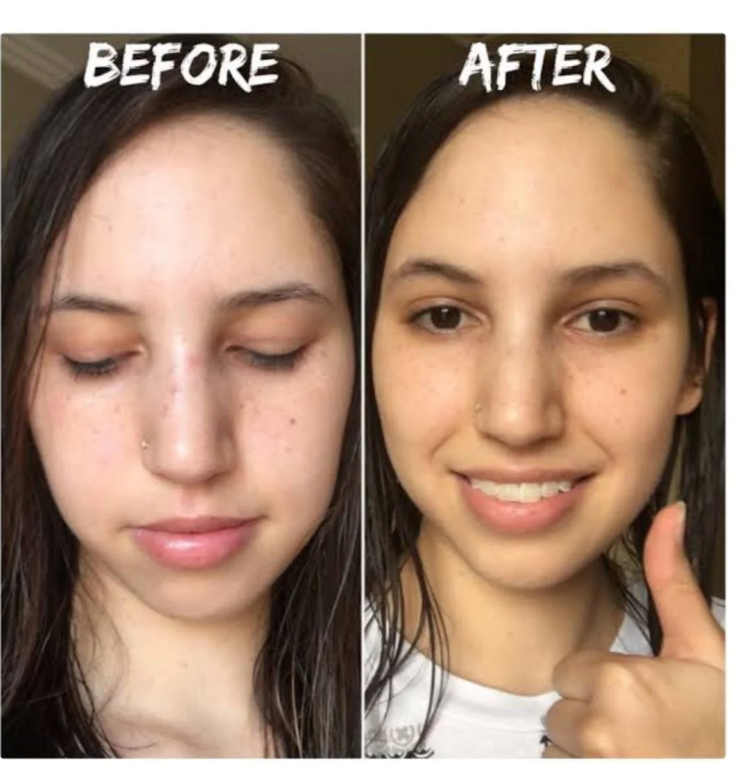 Hydration Boost Facial